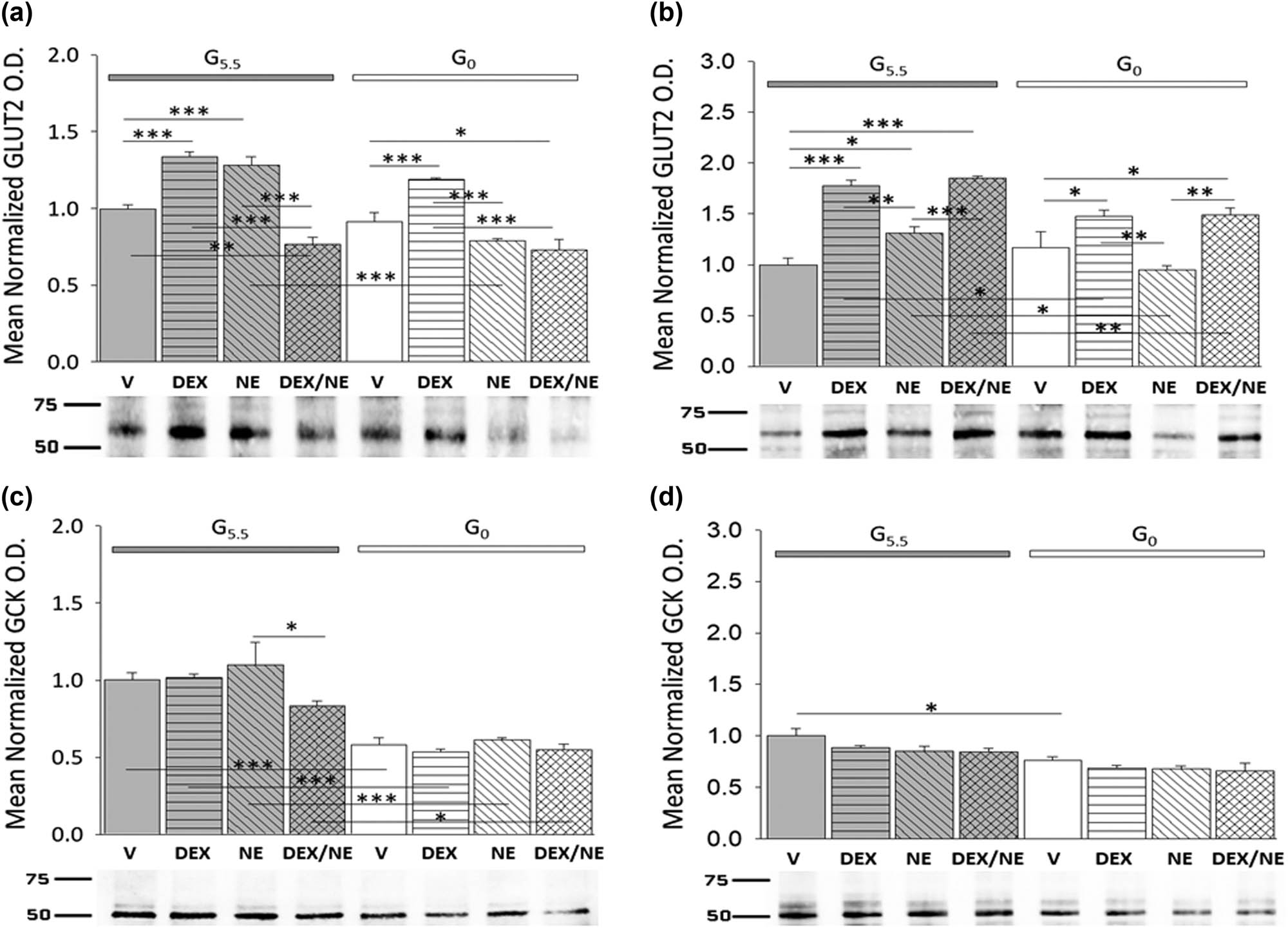 Figure 2 
               Effects of the GR agonist DEX alone or in combination with the catecholamine transmitter NE on GLUT2 and GCK protein expression in glucose-supplied or glucose-deprived male versus female hypothalamic primary astrocyte cultures. Astrocyte cultures derived from adult rats of each sex were pre-incubated in steroid-free media (18 h) prior to incubation (8 h) with HBSS media supplemented with 5.5 (G5.5) or 0 mM (G0) glucose containing DEX (10 nM), NE (100 nM), DEX (10 nM) plus NE (100 nM), or vehicle (V; DMSO) alone. Data show mean normalized GLUT2 (a: male n = 3 independent experiments per treatment group and b: female n = 3 independent experiments per treatment group) or GCK (c: male n = 3 independent experiments per treatment group and d: female n = 3 independent experiments per treatment group) protein O.D. measures ± S.E.M. for male and female G5.5- (gray bars) or G0- (white bars) exposed astrocytes divided into the following treatment groups: V (solid bars), DEX (horizontal-striped bars), NE (diagonal-striped bars), DEX/NE (cross-hatched bars). Data were analyzed by two-way ANOVA and Student Newman Keuls post-hoc test. Statistical differences between treatment groups are indicated by the following symbols: *p < 0.05; **p < 0.01; and ***p < 0.001.
            