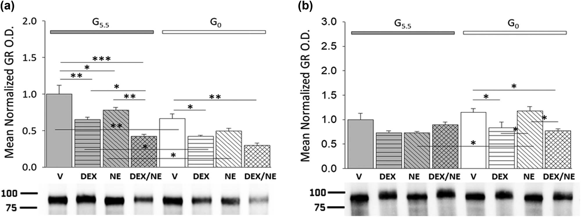 Figure 5 
               Patterns of hypothalamic astrocyte GR protein expression after treatment with DEX, NE, or DEX plus NE. Data illustrate mean normalized male (a: n = 3 independent experiments per treatment group) and female (b: n = 3 independent experiments per treatment group) astrocyte GR protein O.D. values ± S.E.M. after the following treatments: G5.5- or G0-V, G5.5- or G0-DEX, G5.5- or G0-NE, G5.5- or G0-DEX/NE. Data were analyzed by two-way ANOVA and Student Newman Keuls post-hoc test. Statistical differences between treatment groups are indicated by the following symbols:*p < 0.05; **p < 0.01; and ***p < 0.001.
            