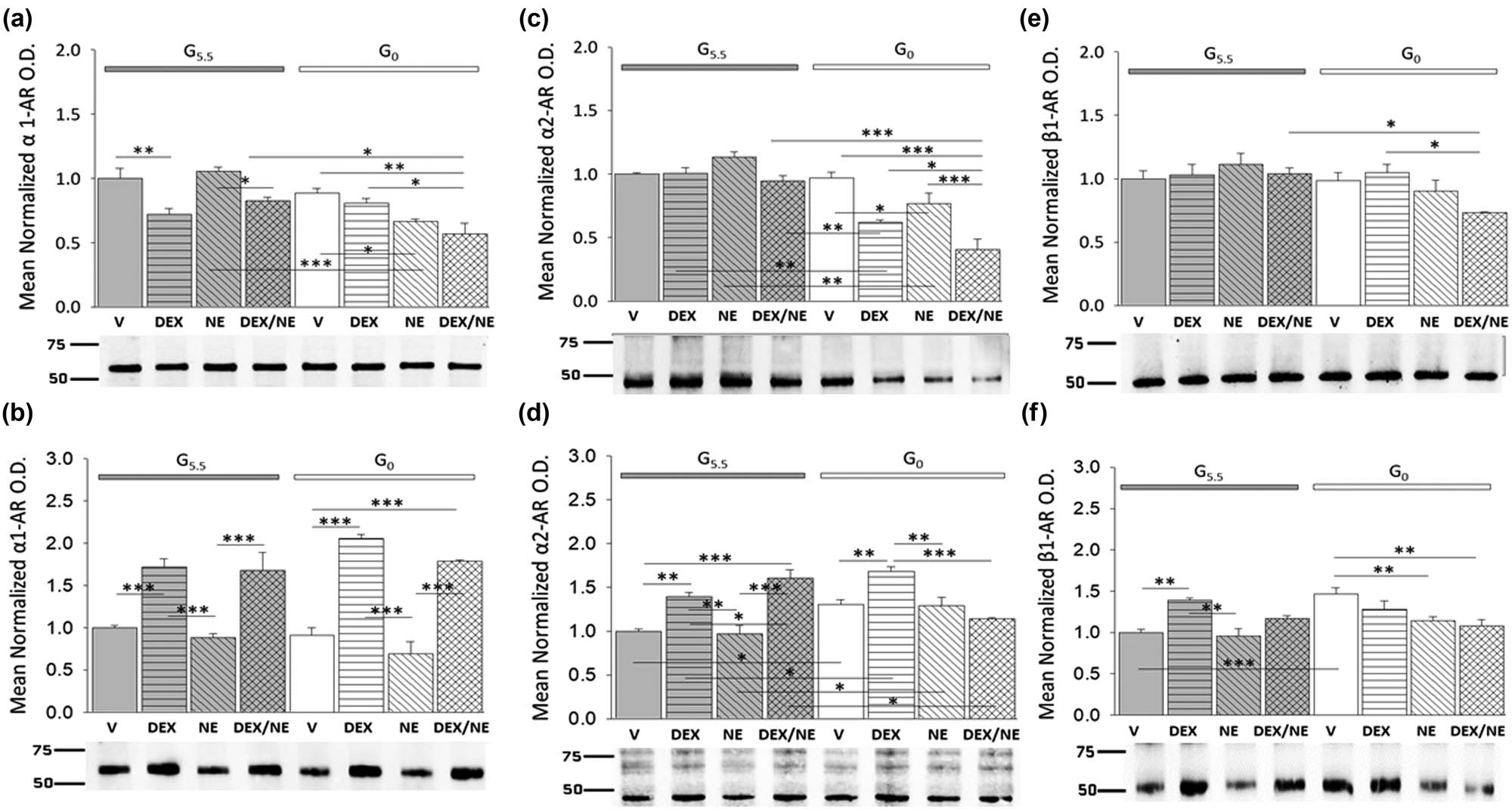 Figure 6 
               Impact of glucose provision versus starvation on DEX- or NE-associated patterns of α1-AR, α2-AR, and β1-AR protein expression in male and female hypothalamic primary astrocyte cultures. Data illustrate mean normalized α1-AR (a and b: n = 3 independent experiments/sex/treatment group), α2-AR (c and d: n = 3 independent experiments/sex/treatment group), or β1-AR (e and f: n = 3 independent experiments/sex/treatment group) protein O.D. values ± S.E.M. for glucose-supplied (G5.5; gray bars) or glucose-deprived (G0; white bars) male and female astrocytes assigned to the following treatment groups: G5.5- or G0-V (solid bars), G5.5- or G0-DEX (horizontal-striped bars), G5.5- or G0-NE (diagonal-striped bars), G5.5- or G0-DEX/NE (cross-hatched bars). Data were analyzed by two-way ANOVA and Student Newman Keuls post-hoc test. Statistical differences between treatment groups are indicated by the following symbols: *p < 0.05; **p < 0.01; and ***p < 0.001.
            