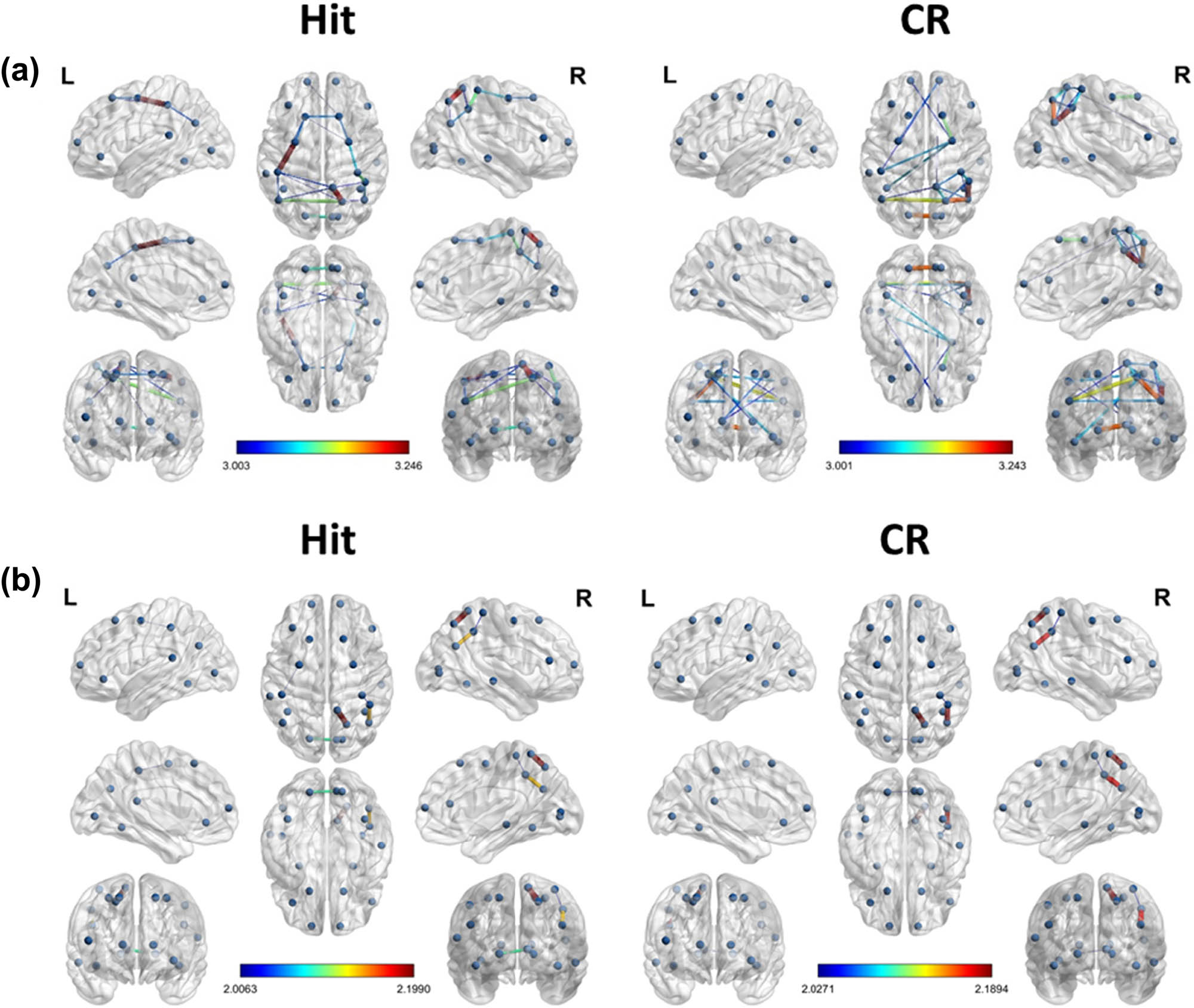 Figure 2 
                  Result of the t-test for the brain connectivity of MI (hit vs CR, p < 0.05). The nodes selected in this study are PFC, DLPFC, VLPFC, FC, TC, PC, and OC. (a) Theta band brain connectivity of MI during hit (left) and CR (right) conditions. (b) Gamma band brain connectivity of MI during hit (left) and CR (right) conditions.
               
