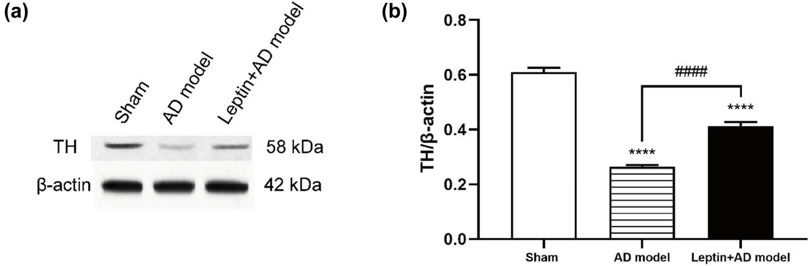 Figure 2 
                  Leptin restored neuronal loss to some extent in AD mice. (a) Western blotting analysis of TH expression in the sham group, AD model group, and leptin + AD model group. (b) Semi-quantitative analysis of TH expression in the sham group, AD model group, and leptin + AD model group. #
                     p < 0.05 vs AD model; *
                     p < 0.05 vs sham.
               
