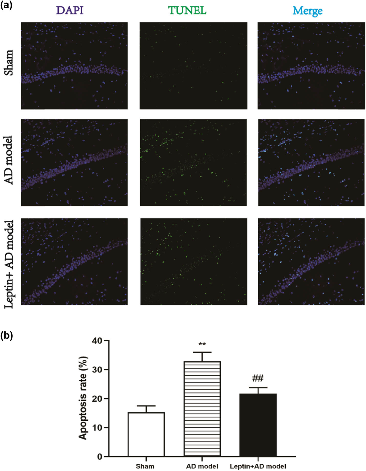 Figure 3 
                  Leptin protected neuronal apoptosis to some extent in AD mice. (a) In the sham group, AD model group, and leptin + AD model group, the nuclei were stained by blue DAPI, the green TUNEL positive cells represented apoptotic cells, and merge meant co-localization of DAPI (blue) with TUNEL (green). Magnification ×200. (b) Quantitative analysis of the apoptosis rate in the sham group, AD model group, and leptin + AD model group. #
                     p < 0.05 vs AD model; *
                     p < 0.05 vs sham.
               