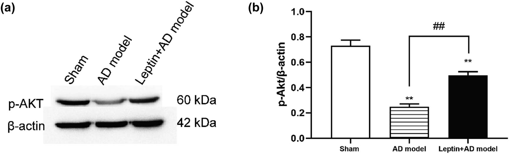 Figure 5 
                  Leptin activated the p-AKT signaling pathway. (a) Western blotting analysis of p-AKT expression in the sham group, AD model group, and leptin + AD model group. (b) Semi-quantitative analysis of p-AKT expression in the sham group, AD model group, and leptin + AD model group. #
                     p < 0.05 vs AD model; *
                     p < 0.05 vs sham.
               