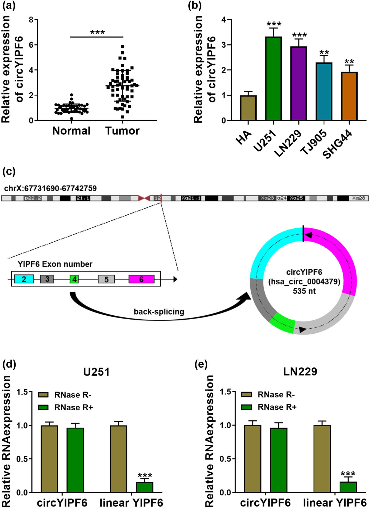 Figure 1 
                  circYIPF6 is highly expressed in glioma tissues and cells. (a) The expression of circYIPF6 in glioma tissues (n = 57) and normal brain tissues (n = 43) was detected by qRT-PCR. (b) The expression of circYIPF6 in glioma cells (U251, LN229, TJ905, and SHG44) and human normal astrocytes (HA) was detected by qRT-PCR (n = 3). (c) Genomic location and formation of circYIPF6. (d and e) qRT-PCR for the expression of circYIPF6 and linear YIPF6 in glioma cells treated with RNase R (n = 3). ***P < 0.001, **P < 0.01.
               