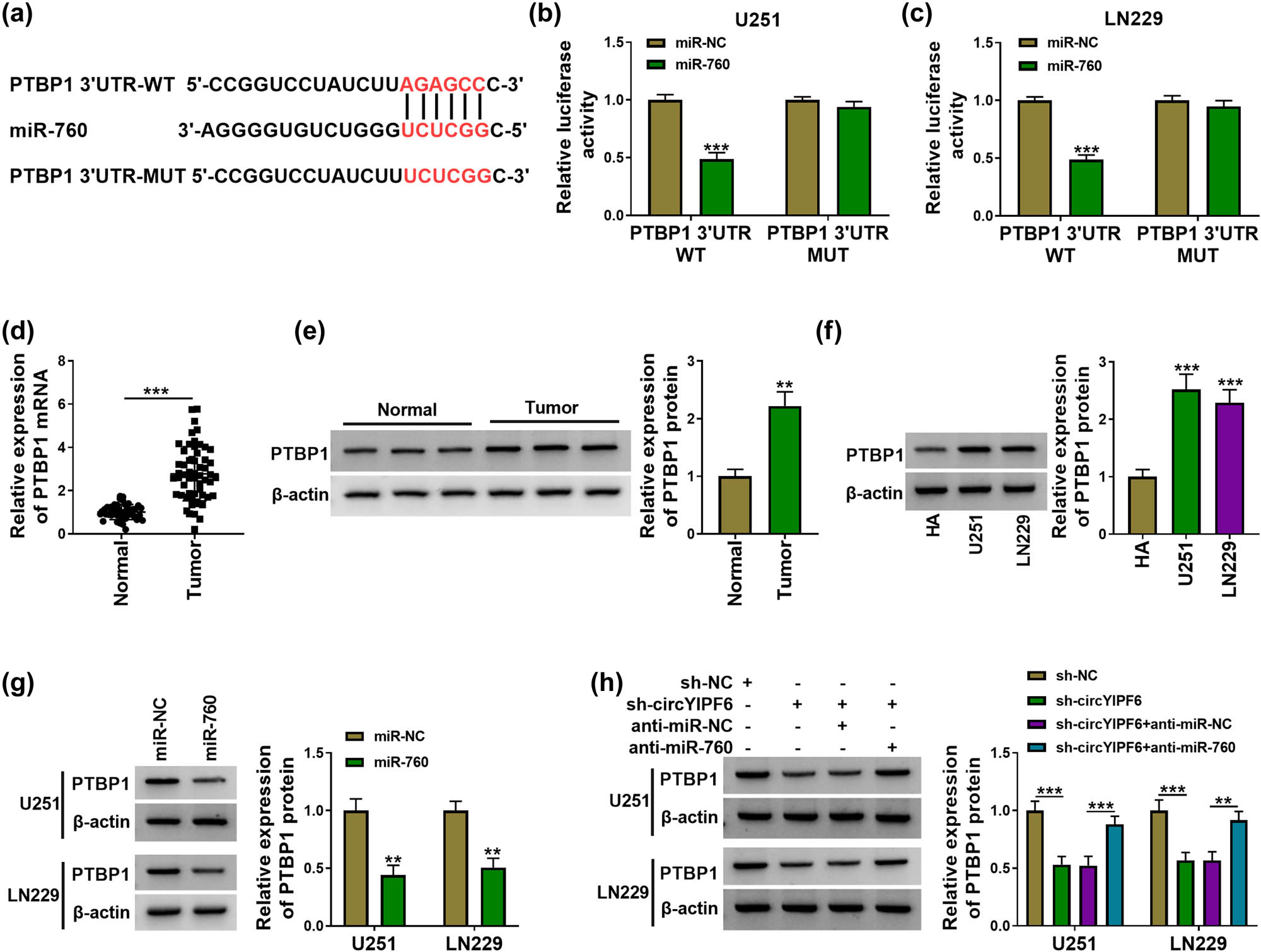 Figure 5 
                  circYIPF6 regulates the expression of PTBP1 through sponging miR-760. (a) The predicted miR-760 binding sites in the 3′UTR of PTBP1 mRNA. (b and c) Luciferase reporter activity of PTBP1 3′UTR-WT or PTBP1 3′UTR-MUT in glioma cells after transfection with miR-760 (n = 3). (d) mRNA expression of PTBP1 in tumor tissues (n = 57) and normal tissues (n = 43) were assayed by qRT-PCR. (e) The protein level of PTBP1 in tumor tissues (n = 57) and normal tissues (n = 43) was analyzed by western blot. (f) The protein level of PTBP1 in cells was examined by western blot (n = 3). (g) Western blot analysis of PTBP1 protein expression after miR-760 mimics or miRNA mimics transfection (n = 3). (h) Western blot analysis of PTBP1 protein expression after sh-NC, sh-circYIPF6, sh-circYIPF6 + anti-miR-NC, or sh-circYIPF6 + anti-miR-760 transfection (n = 3). ***P < 0.001, **P < 0.01.
               