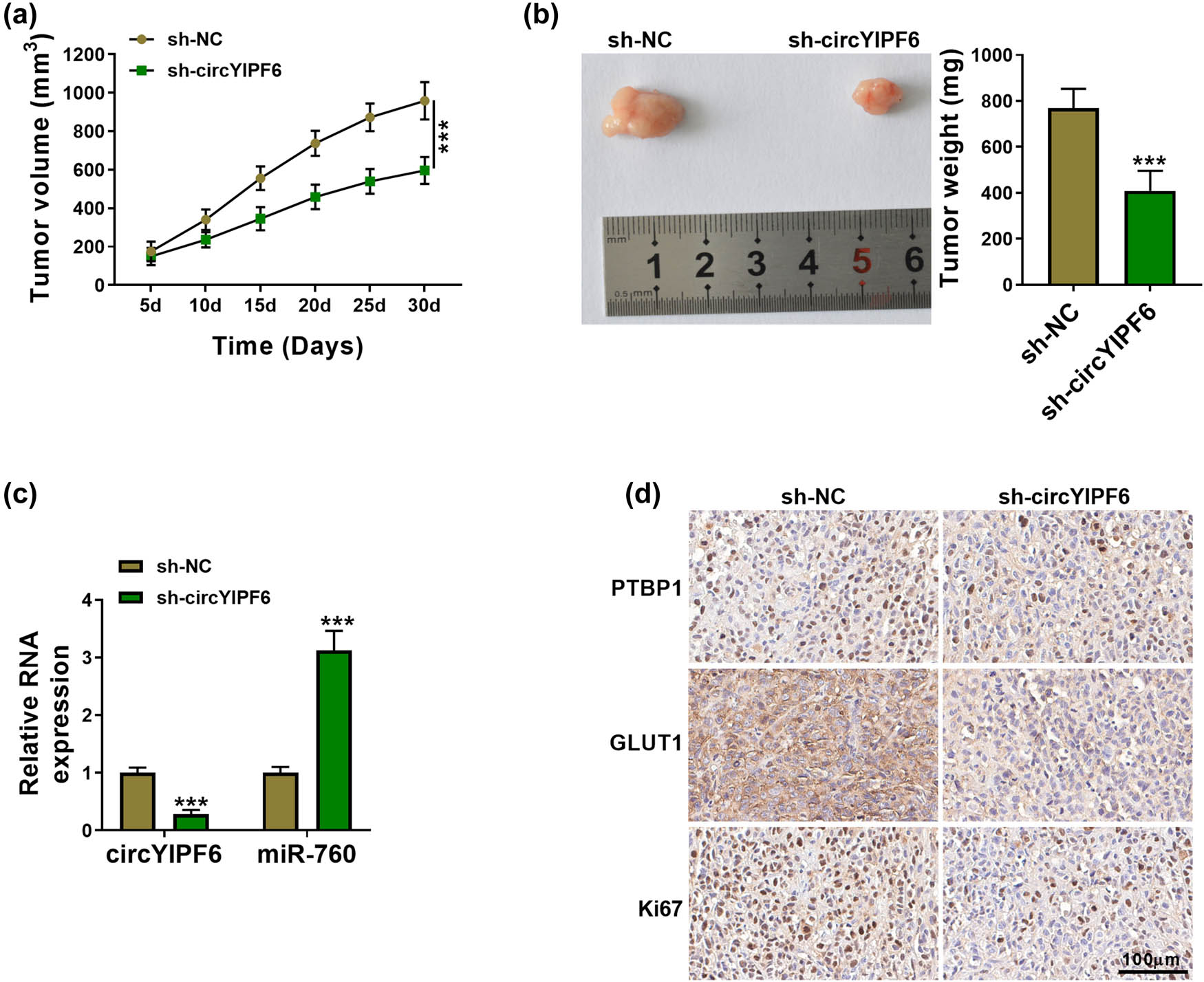 Figure 7 
                  Knockdown of circYIPF6 repressed glioma tumor growth in vivo. (a) Tumor volume growth curve of each group (n = 5). (b) Representative picture (left) and tumor weight (right) of the tumors (n = 5). (c) The expression of circYIPF6 and miR-760 in xenograft tumors was detected by qRT-PCR (n = 5). (d) IHC analysis examining PTBP1, GLUT1, and Ki67 levels in xenograft tumors (n = 5). ***P < 0.001.
               