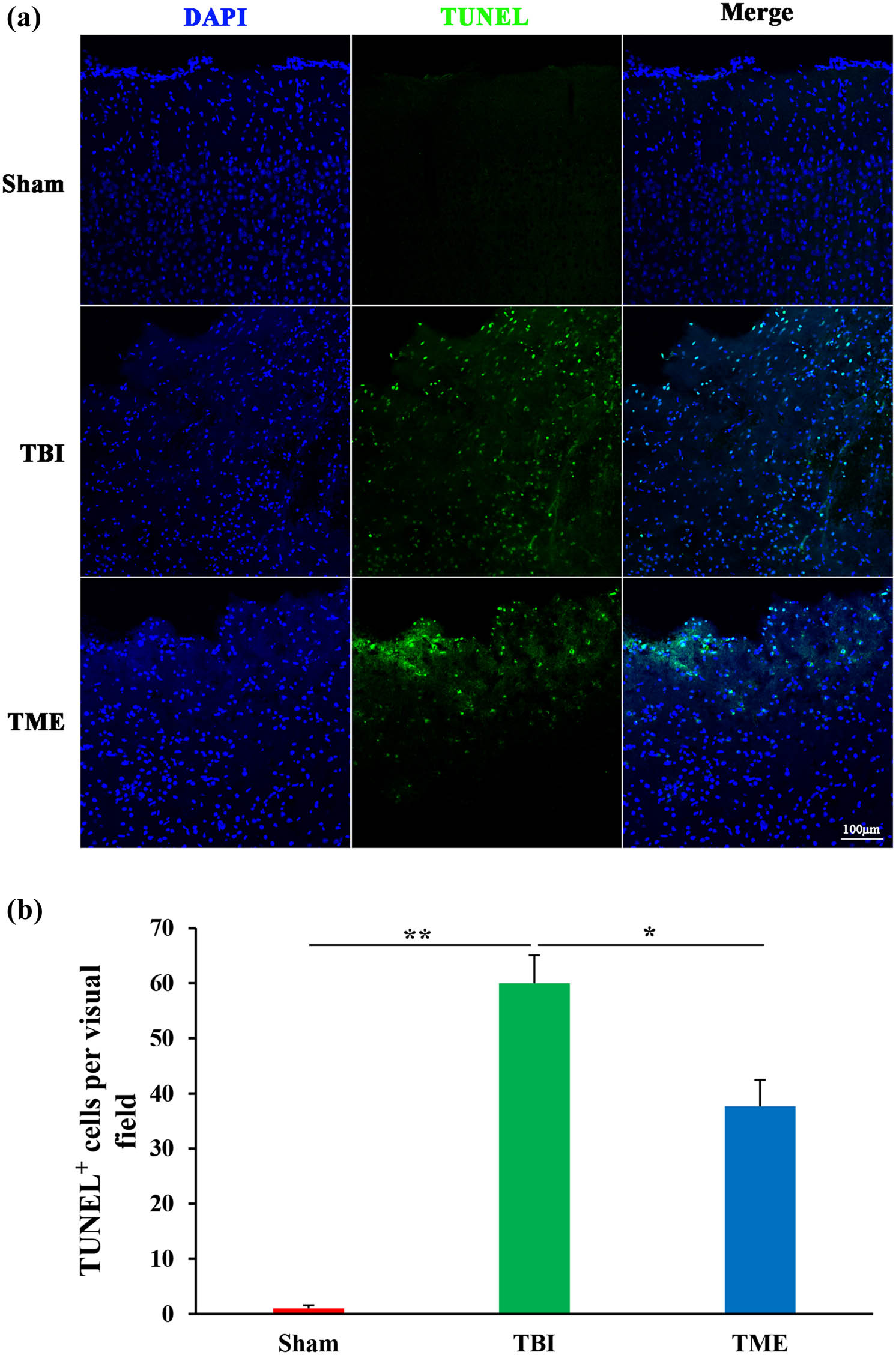 Figure 2 
                  Inhibition of HIF-1α attenuated TBI-induced apoptosis. (a) Representative images of TUNEL staining. (b) Quantification of TUNEL-positive cells in Sham, TBI, and 2ME2-treated groups (n = 3–4 rats per group). The difference was determined by one-way ANOVA (F(2,7) = 46.49, P = 9.08 × 10−5) followed by the Tukey HSD post hoc test. TBI, traumatic brain injury; 2ME2, 2-methoxyestradiol. Data are expressed as mean values ± SEM. *P < 0.05; **P < 0.01.
               