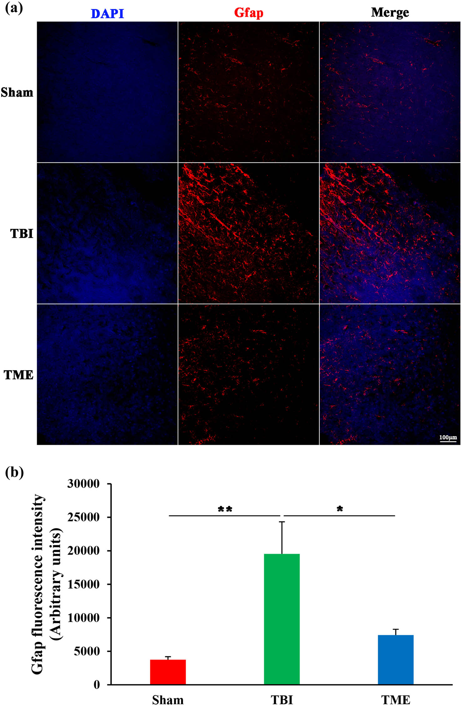 Figure 6 
                  Inhibition of HIF-1α ameliorated TBI-induced activation of astrocytes. (a) Representative images of Iba1 staining. (b) Quantification of GFAP fluorescence intensity (n = 5–6 rats per group). The difference was determined by one-way ANOVA (F(2,13) = 6.997, P = 0.00866) followed by the Tukey HSD post hoc test. TBI, traumatic brain injury; 2ME2, 2-methoxyestradiol. Data are expressed as mean values ± SEM. *P < 0.05; **P < 0.01.
               