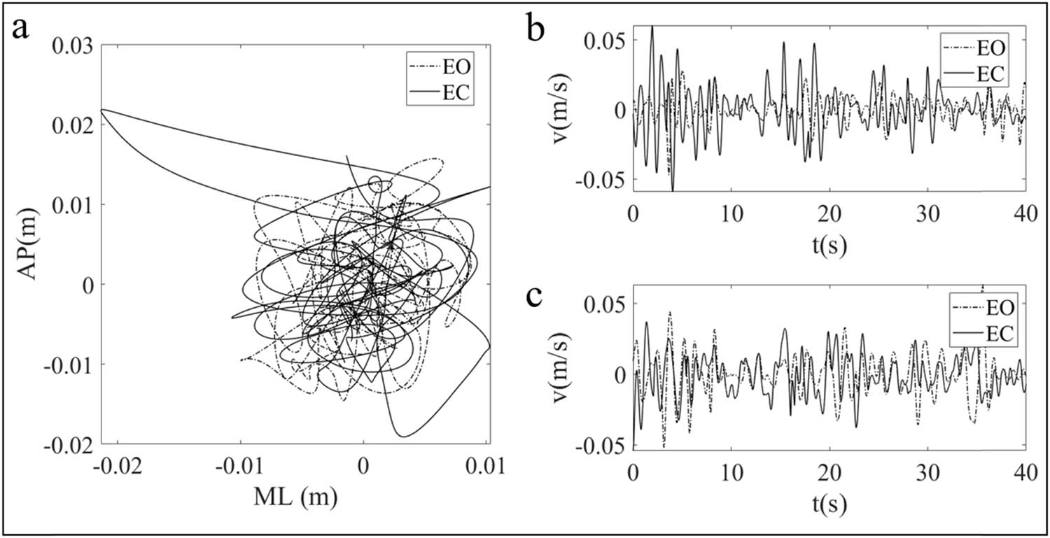 Figure 3 
               (a) The typical COP sway trajectories under the conditions of EO and EC. (b) Time sequential diagrams of COP sway velocity in the AP direction with EO and EC. (c) Time sequential diagrams of COP sway velocity in the ML direction with EO and EC.
            