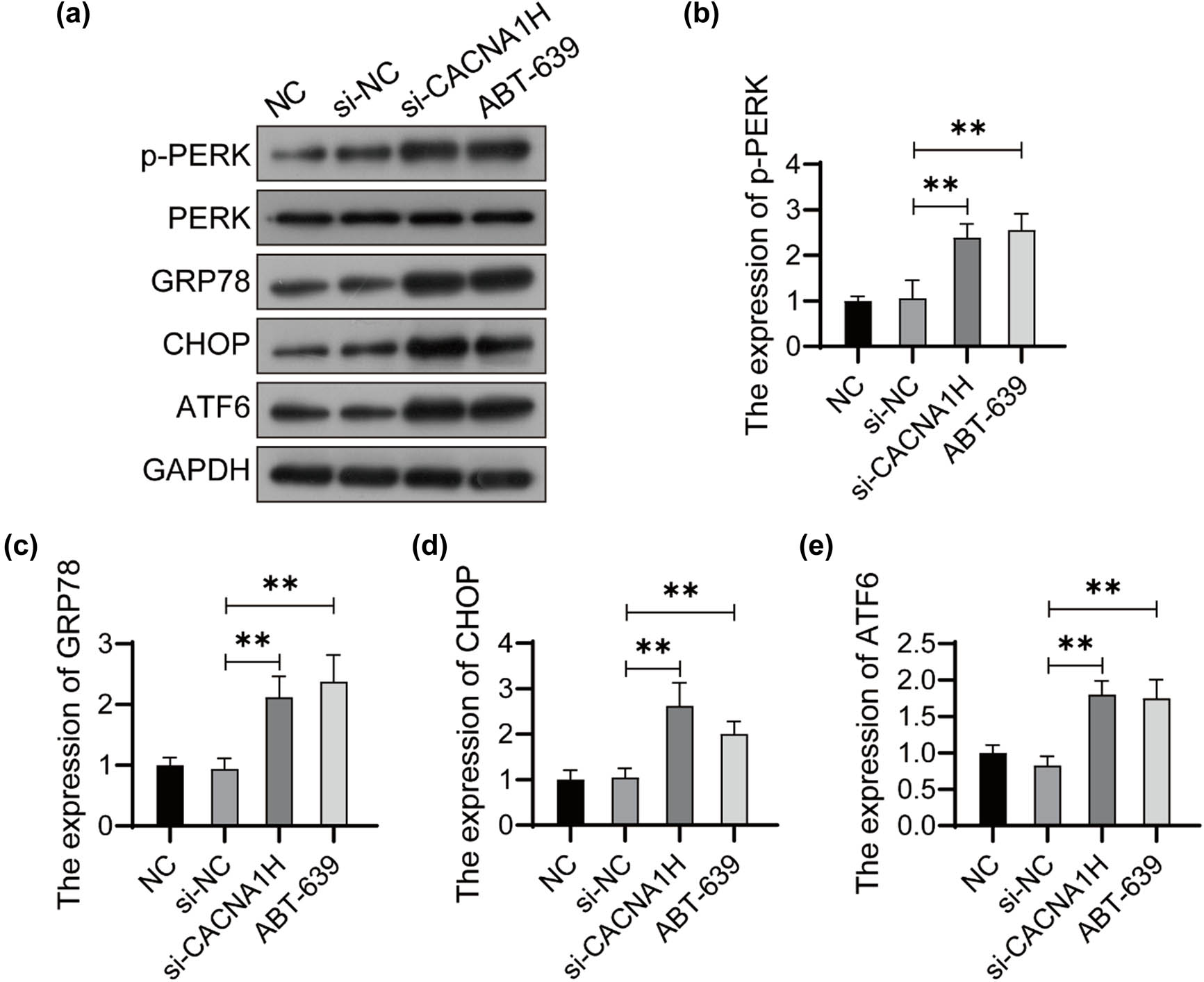 Figure 2 
                  Knockdown of CACNA1H activates ERS in U251 cells. (a) The expression of ERS-related proteins was detected using western bolt. The relative expression of p-PERK (b), GRP78 (c), CHOP (d), and ATF6 (e) was analyzed using ImageJ software. **P < 0.01.
