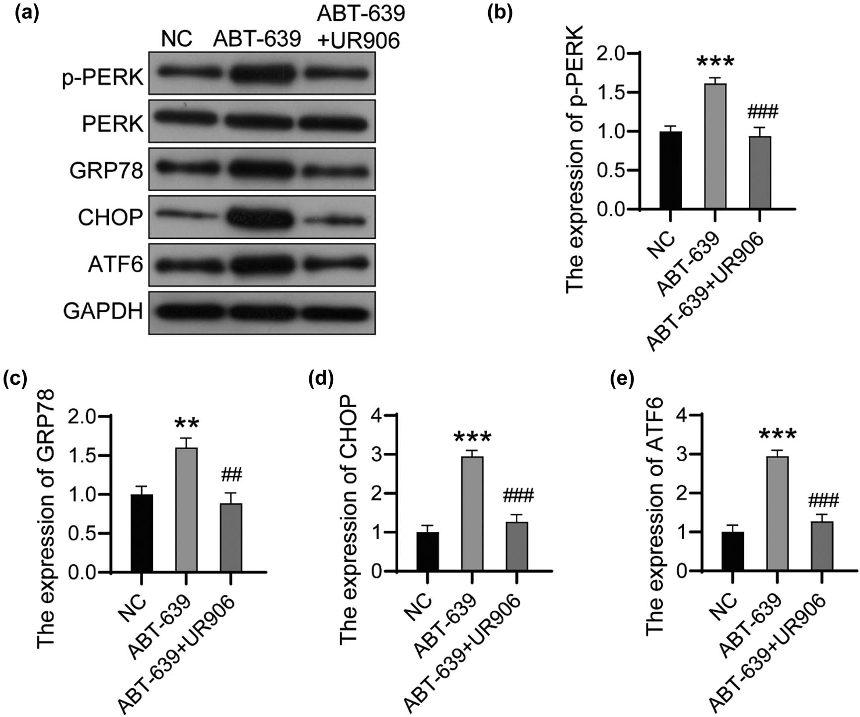 Figure 5 
                  UR906 blocked the activation of ERS induced by ABT-639. (a) The expression of ERS-related proteins was detected using western bolt. The relative expression of p-PERK (b), GRP78 (c), CHOP (d), and ATF6 (e) was analyzed using ImageJ software. **P < 0.01 vs NC group; ***P < 0.001 vs NC group; ##
                     P < 0.01 vs ABT-639 group; ###
                     P < 0.001 vs ABT-639 group.