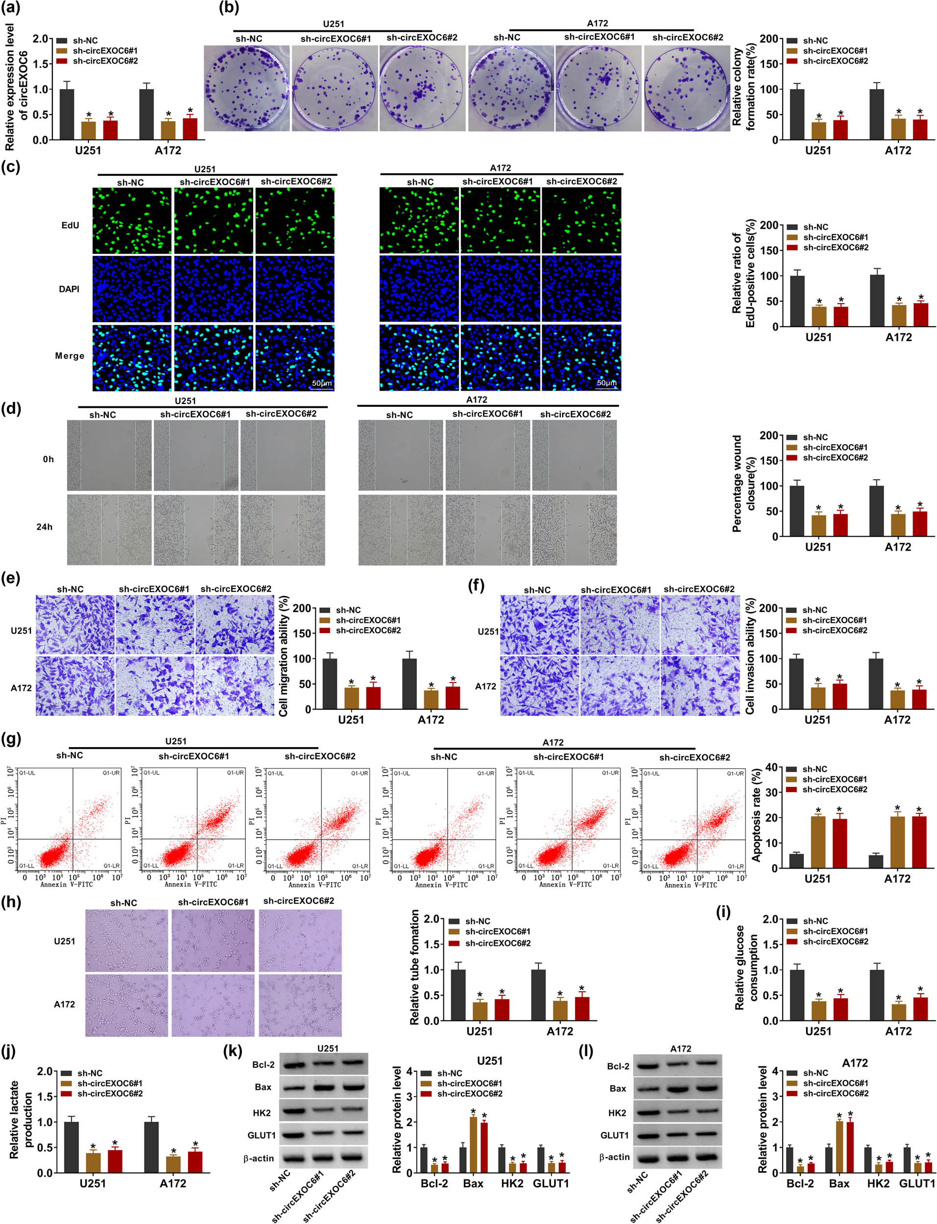 Figure 2 
                  Lowly expressed circEXOC6 inhibited the proliferation, migration, invasion, angiogenesis, and glycolysis, and boosted the apoptosis of glioma cells. (a–l) U251 and A172 cells were transfected with sh-NC, sh-circEXOC6#1, or sh-circEXOC6#2. (a) The efficiency of shRNA sequences targeting circEXOC6 was analyzed in U251 and A172 cells. (b) and (c) Colony formation and EdU assay were used to check cell proliferation. (d)–(f) Wound healing and transwell assays were performed to assess cells migration and invasion. (g) Cell apoptosis was measured by flow cytometry assay. (h) Tube formation assay was used to determine tumor angiogenesis. (i) and (j) Glucose consumption and lactate production were analyzed to assess cell glycolysis. (k)–(l) The protein levels of apoptosis-related proteins (Bcl-2 and Bax) and glycolysis-related proteins (HK2 and GLUT1) were examined by western blot assay. All experiments were performed in triplicate, with each independent experiment set three times to generate an average value. *P < 0.05.
               