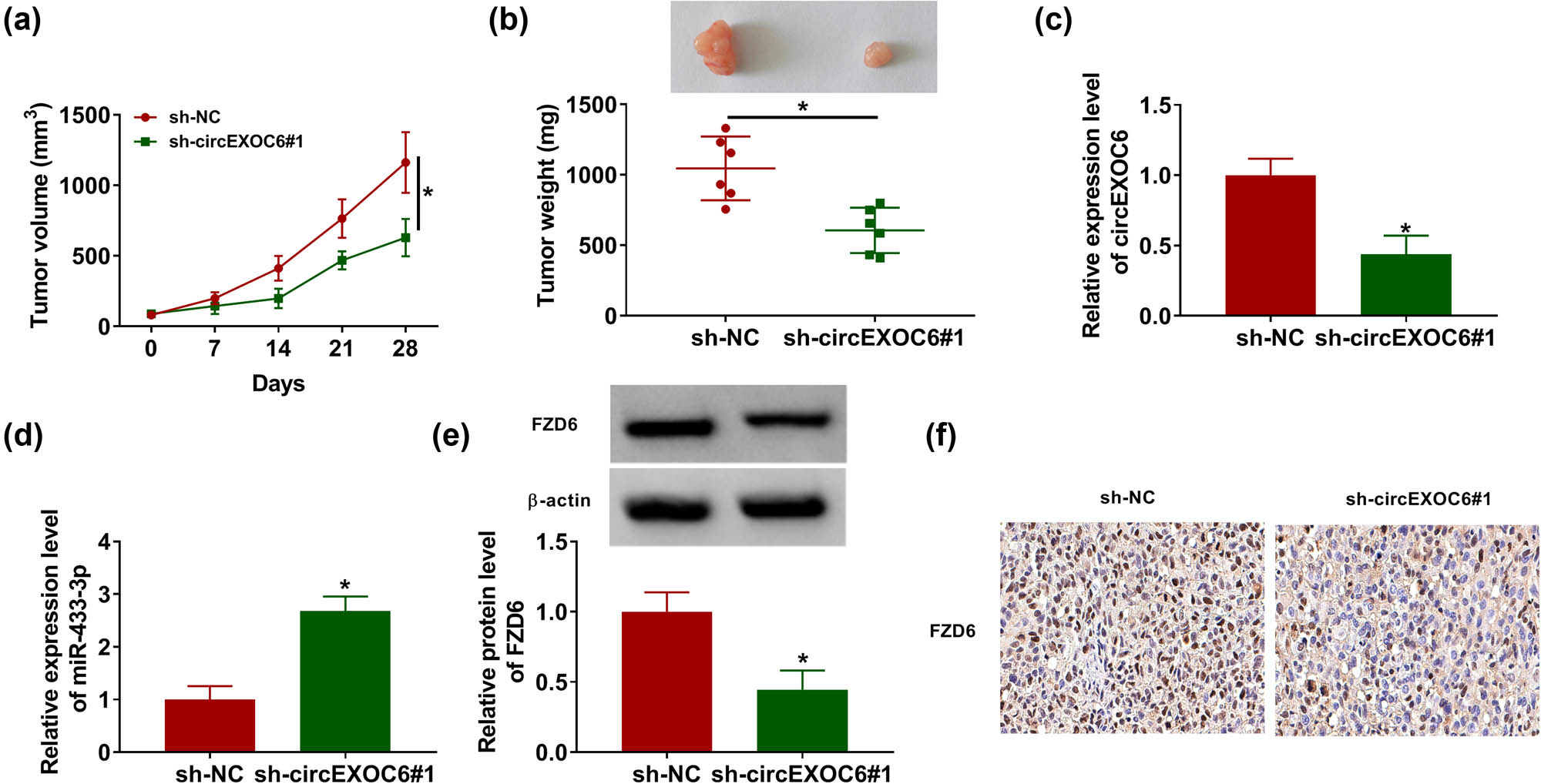 Figure 7 
                  Downregulated circEXOC6 hindered glioma growth in vivo. A172 cells containing sh-NC or sh-circEZOC6#1 were subcutaneously injected into nude mice. (a) Tumor volumes were evaluated every one week. (b) Tumor size was measured after 28 days. (c)–(e) The expression levels of circEXOC6, miR-433-3p, and FZD6 were determined by qRT-PCR or western blot assay. (f) FZD6 expression in the xenograft tumor was determined by using IHC. All experiments were performed in triplicate, with each independent experiment set three times to generate an average value. *P < 0.05.
               
