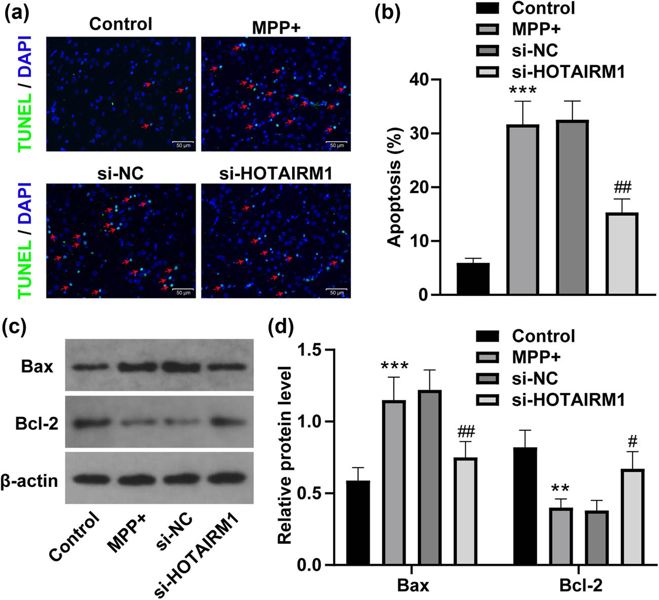 Figure 3 
                  HOTAIRM1 knockdown inhibits MPP+-induced SH-SY5Y cell apoptosis. SH-SY5Y cells were transfected with si-NC and si-HOTAIRM1MPP+ for 24 h before cells were challenged by 1.0 mM MPP+ for 24 h. (a) TUNEL assay was conducted to assess apoptosis (red arrow indicating apoptosis). (b) Apoptotic analysis of (a). (c) The gray values of Bax and Bcl-2 were analyzed via western blot analysis. (d) Statistic analysis of the gray values of Bax and Bcl-2 in (c). Compared with the control group, **p < 0.01, ***p < 0.001; compared with the si-NC group, #
                     p < 0.05, ##
                     p < 0.01.
               