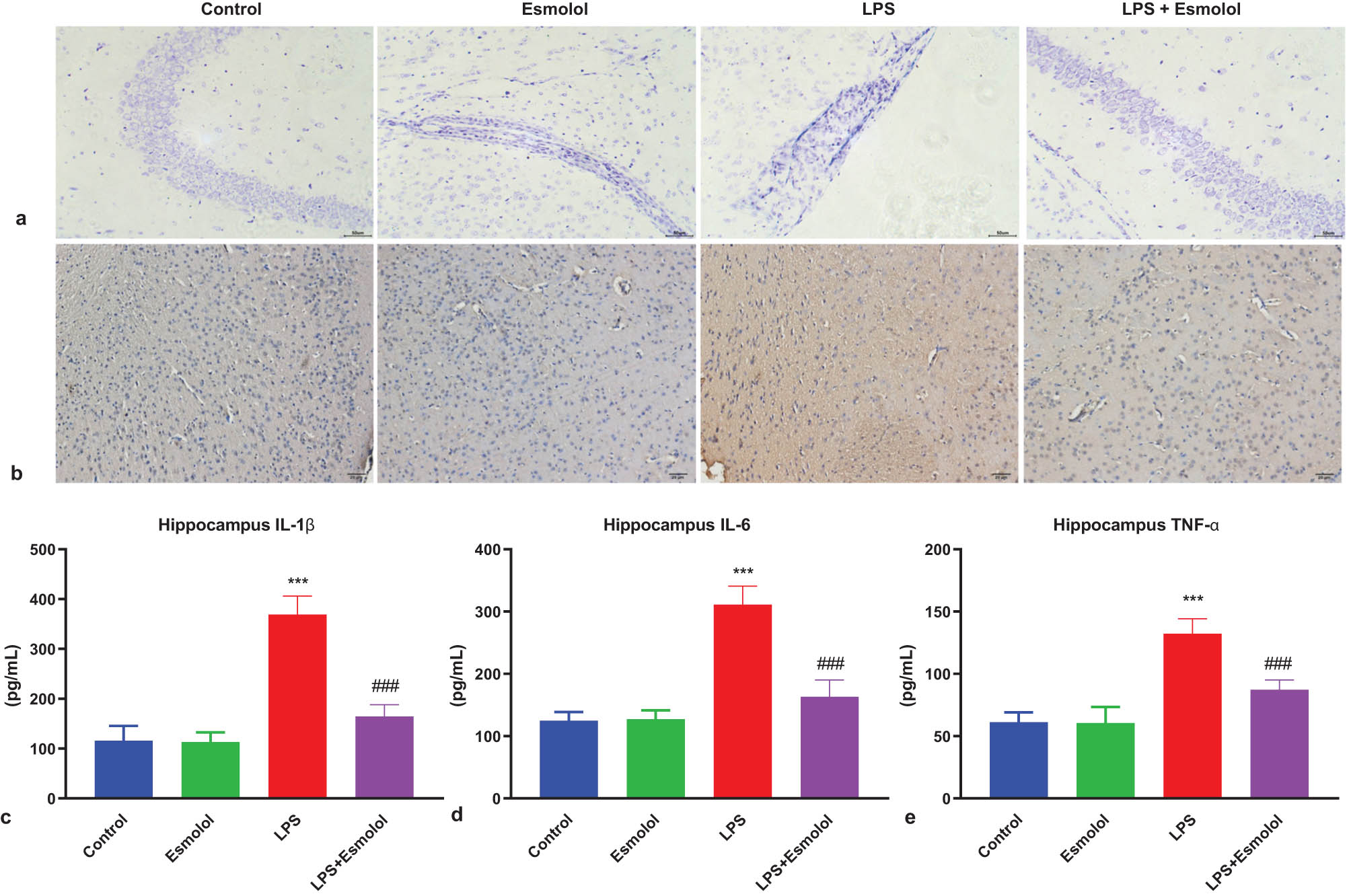 Figure 2 
                  Esmolol ameliorates injury and inflammation in the hippocampus of septic mice. (a) Representative images of Nissl staining in hippocampal tissue following LPS injection (magnification, 200×; scale bar: 50 μm). (b) Representative image of IL-1β expression in the hippocampal CA1 region of LPS mice by immunohistochemistry (magnification, 200×; scale bar: 50 μm). RT-qPCR was used to determine the mRNA expression levels of (c) IL-1β, (d) IL-6, and (e) TNF-α in the hippocampal tissues of mice. Data were shown as mean ± SD (n = 8 per group). ***P < 0.001 vs control group; ###P < 0.001 vs LPS group.
               