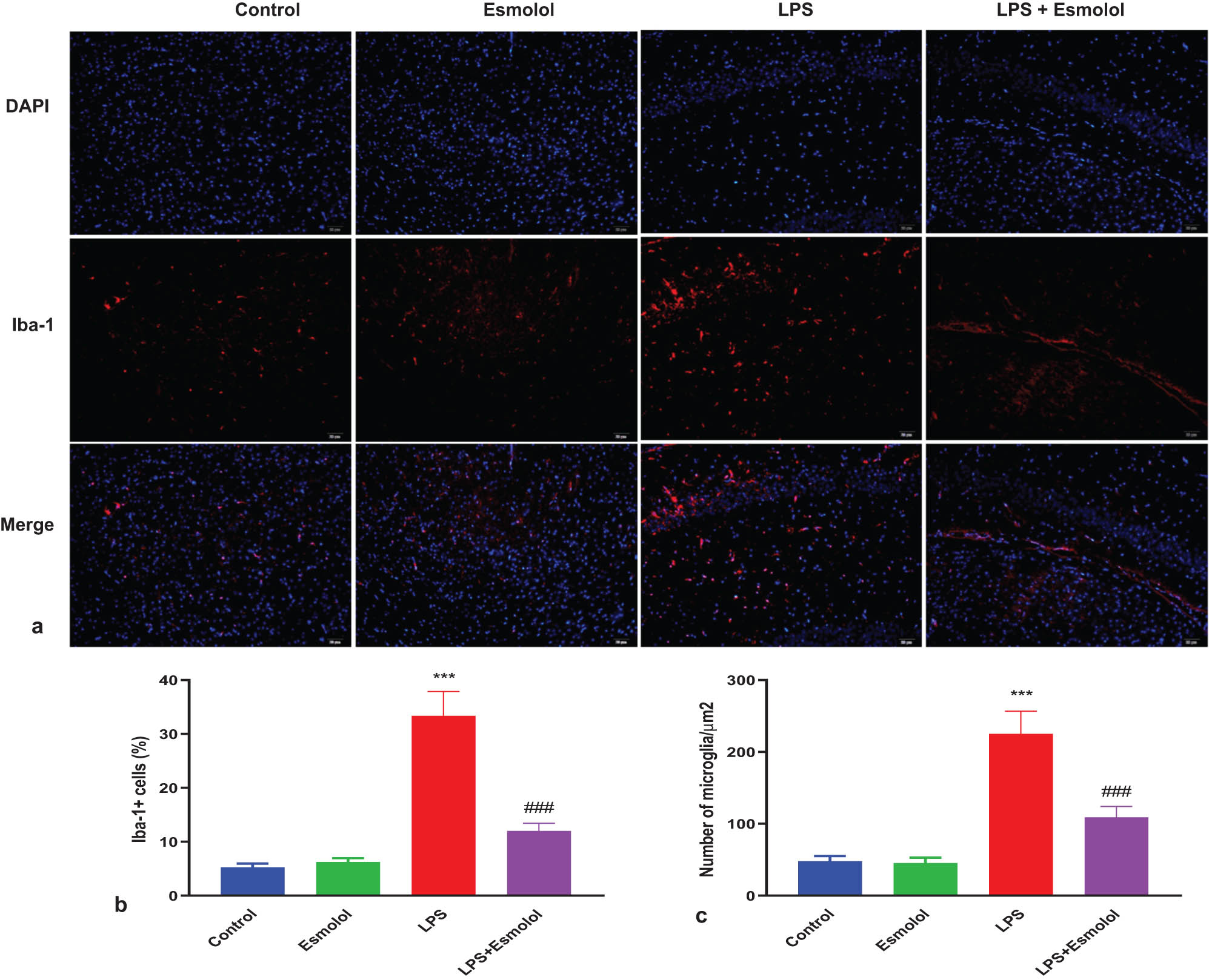 Figure 5 
                  Esmolol reduces microglia activation in septic mice. (a) Representative Iba-1 immunofluorescence staining in the hippocampus of mice treated with esmolol beginning at 6 h before LPS injection (magnification, 200×; scale bar: 50 μm). Statistical analysis of (b) Iba-1 + cell and (c) density of microglia in the hippocampus. Data were shown as mean ± SD (n = 8 per group). ***P < 0.001 vs control group; ###P < 0.001 vs LPS group.
               