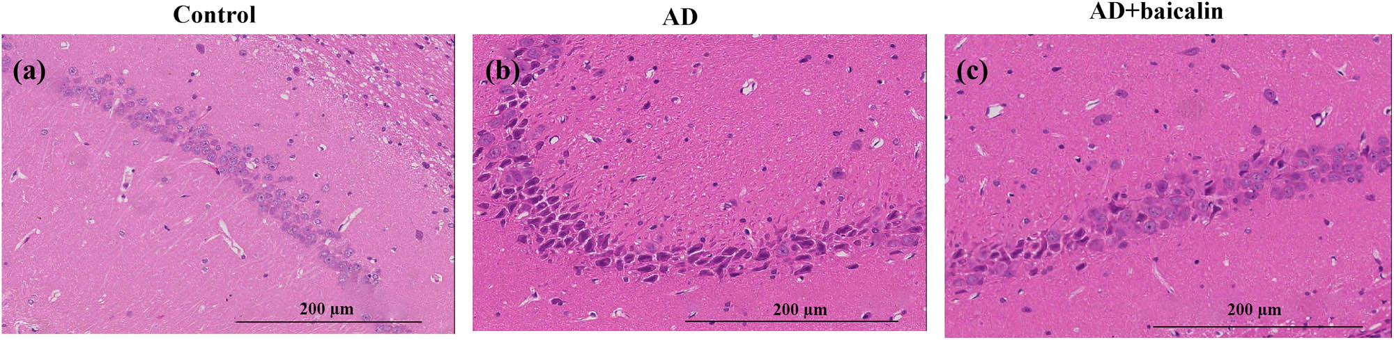 Figure 2 
                  Effect of baicalin on the number of hippocampal neurons: (a) HE staining in the control group, (b) HE staining in the AD group, and (c) HE staining in the AD + baicalin group. Abbreviation: HE, hematoxylin–eosin; AD, Alzheimer’s disease.
               
