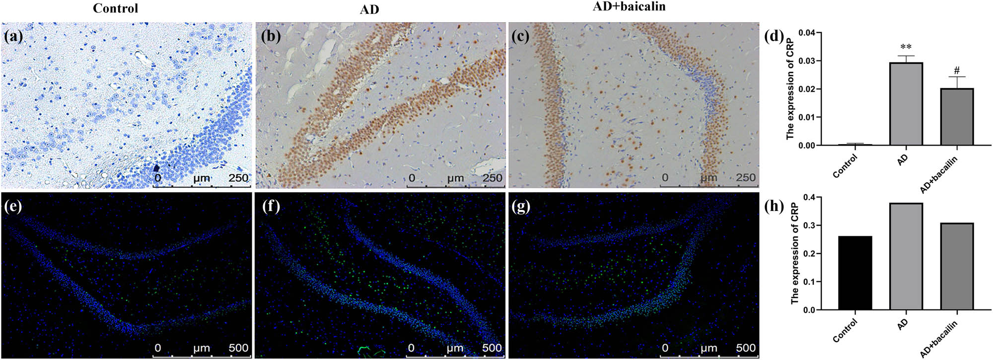 Figure 6 
                  Effect of baicalin on CRP immunohistochemical (a–c) and immunofluorescence (d–f) staining: (a) immunohistochemical staining in the control group, (b) immunohistochemical staining in the AD model group, (c) immunohistochemical staining in the AD + baicalin group, (d) quantification for immunohistochemical staining, (e) immunofluorescence in the control group, (f) immunofluorescence in the AD model group, (g) immunofluorescence in the baicalin group, and (h) quantification for immunofluorescence. Abbreviation: AD: Alzheimer’s disease; NPTX-2: neuronal pentraxin-2; CRP: C-reaction protein.
               