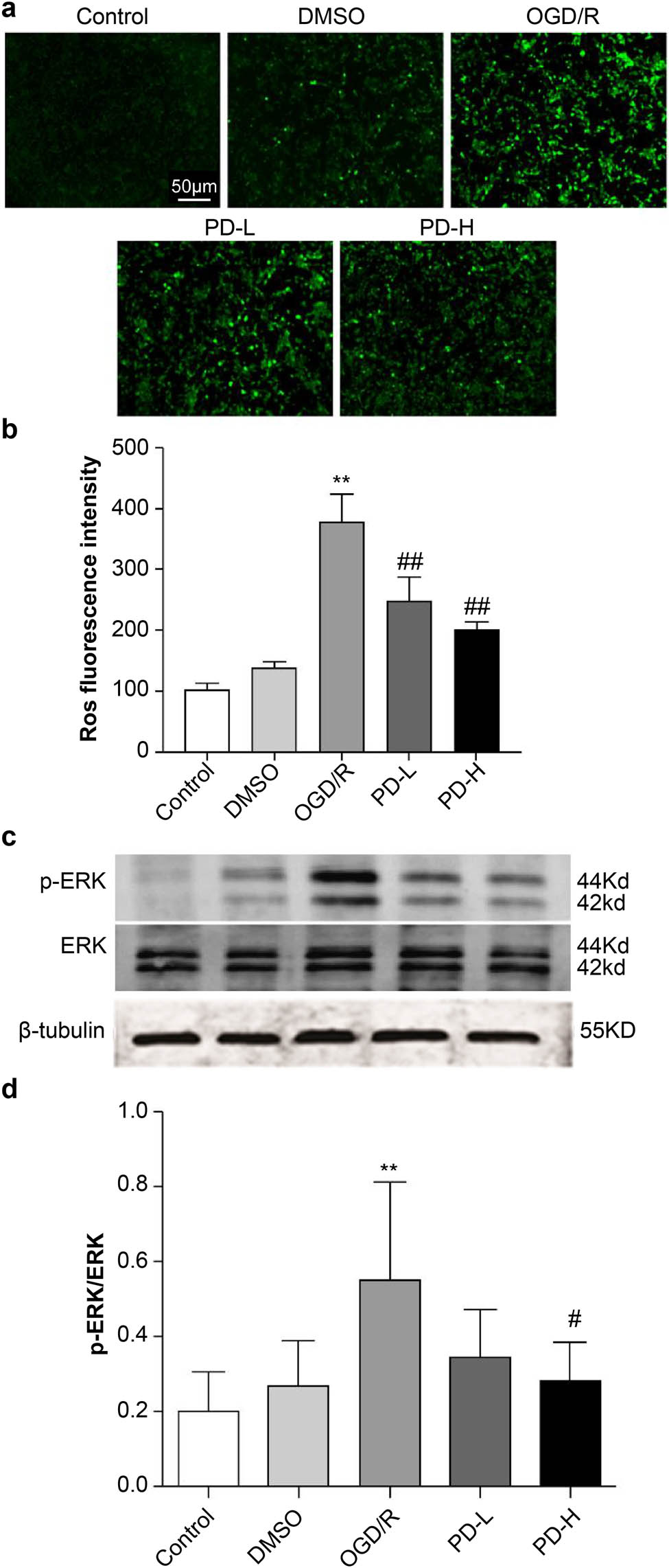 Figure 2 
                  ROS production and p-ERK and ERK expression. (a) ROS fluorescence. (b) ROS fluorescence density. (c) Western blot of p-ERK and ERK. (d) The ratio of p-ERK/ERK. Data are expressed as mean value ± standard deviation (n = 3). **p < 0.01 vs the control group; ##
                     p < 0.01 vs the oxygen–glucose deprivation/reperfusion (OGD/R) group.
               