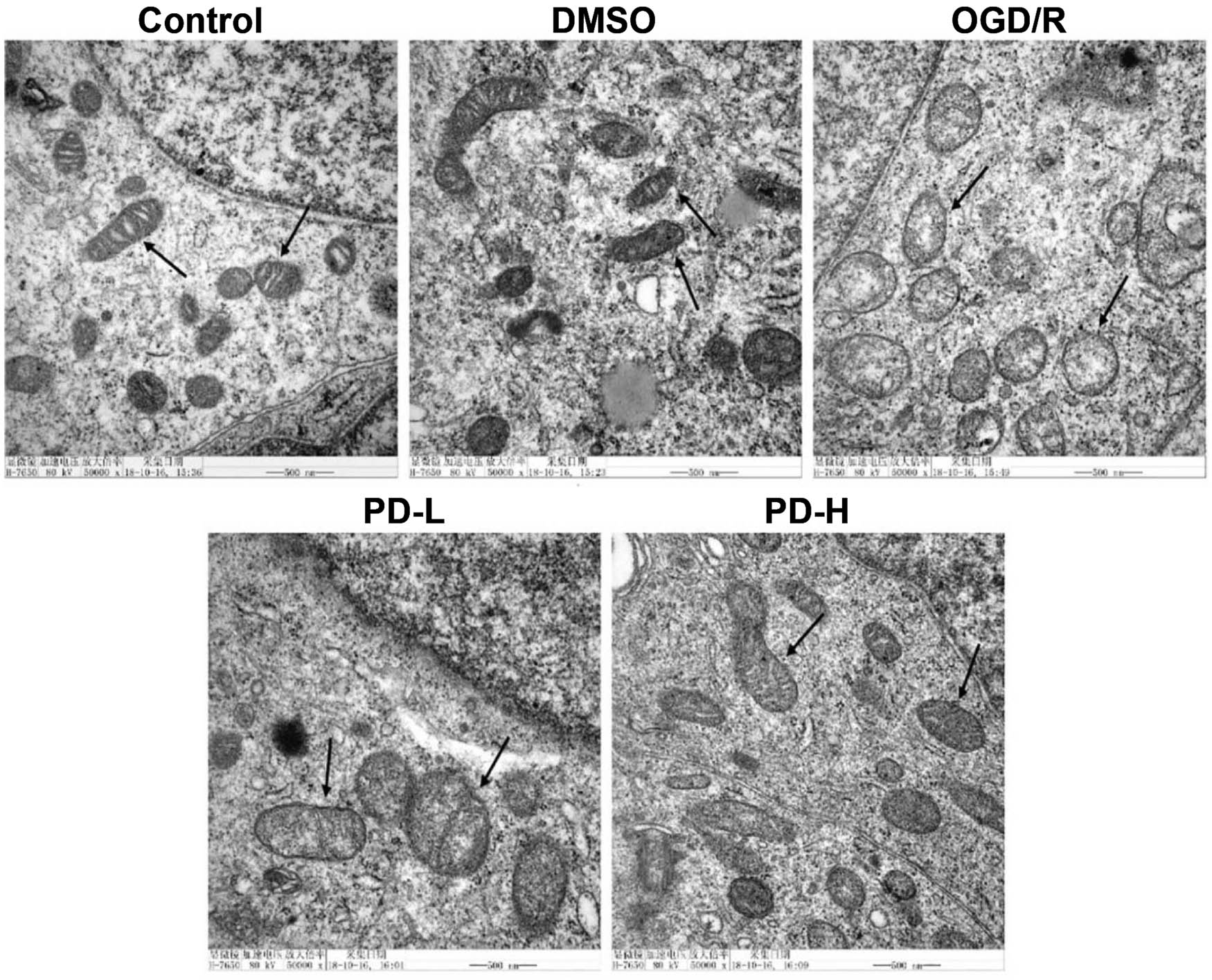 Figure 4 
                  Mitochondrial morphology observed using transmission electron microscopy.
               