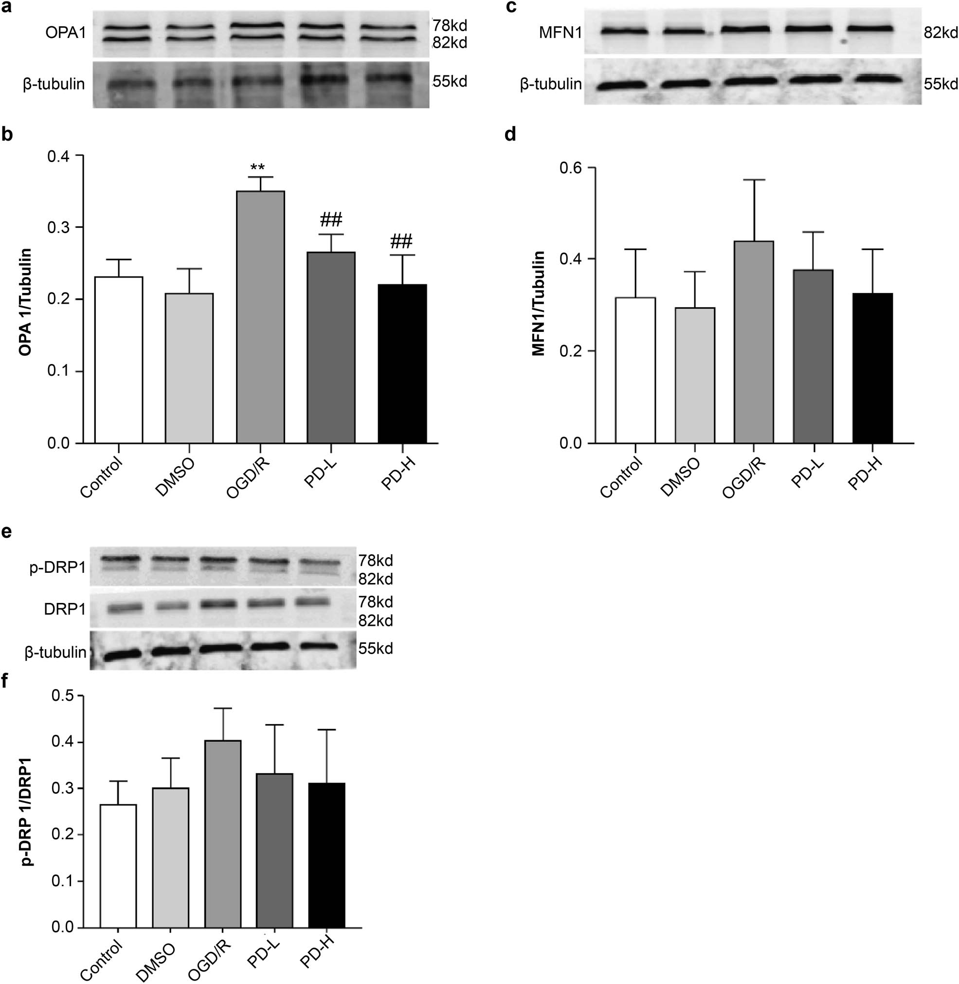 Figure 6 
                  Western blotting of the mitochondrial proteins Mfn1, Opa1, and Drp1. (a) Western blotting of Opa1. (b) Quantification of Opa1 band intensity. (c) Western blotting of Mfn1. (d) Quantification of Mfn1 expression. (e) Western blotting of the mitochondrial fission proteins p-Drp1 and Drp1. (f) Ratio of p-Drp1/Drp1 expression. Overall data are expressed as mean value ± standard deviation (n = 3). **p < 0.01 vs the control group; ##
                     p < 0.01 vs the OGD/R group.
               