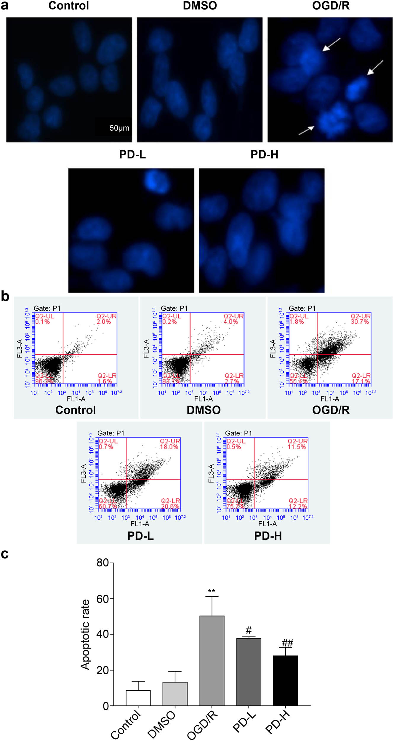 Figure 7 
                  Observation of cell apoptosis. (a) Cell apoptosis observed using Hoechst staining. Images were acquired at 400×. Arrows indicate damaged nuclei. (b and c) The rate of apoptosis was determined using flow cytometry. Data are presented as mean value ± standard deviation (n = 3). **p < 0.01 vs the control group; #
                     p < 0.05 vs the OGD/R group; ##
                     p < 0.01 vs the OGD/R group.
               