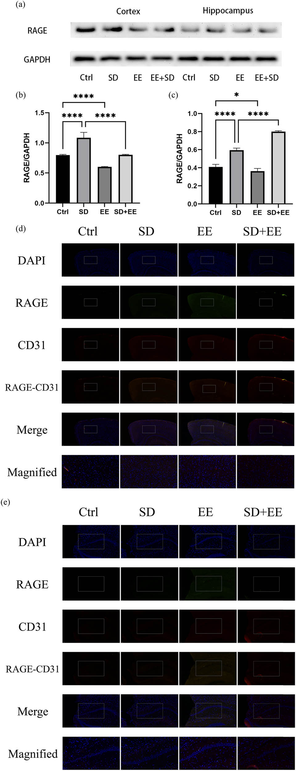 Figure 4 
                  Effect of EE on RAGE expression in chronic sleep-deprived mice. Note: (a) prefrontal cortex and hippocampal RAGE protein bands in each group; (b and c) analysis of grayscale values of prefrontal cortex and hippocampal RAGE/GAPDH in each group; (d) immunofluorescence staining of prefrontal cortex RAGE (green), CD31 (red), and DAPI (blue) in each group, magnification scale bar = 100 μm, other scale bar = 20 μm; (e) immunofluorescence staining of prefrontal cortex and hippocampal RAGE (red), CD31 (green), and DAPI (blue) in each group, magnification scale bar = 50 μm, other scale bar = 20 μm; (f) percentage of CD31-RAGE co-localization area of prefrontal cortex stretching CD31 area in each group; and (g) percentage of CD31-RAGE co-localization area of hippocampal stretching CD31 area in each group (n = 3, ****P < 0.001).
               