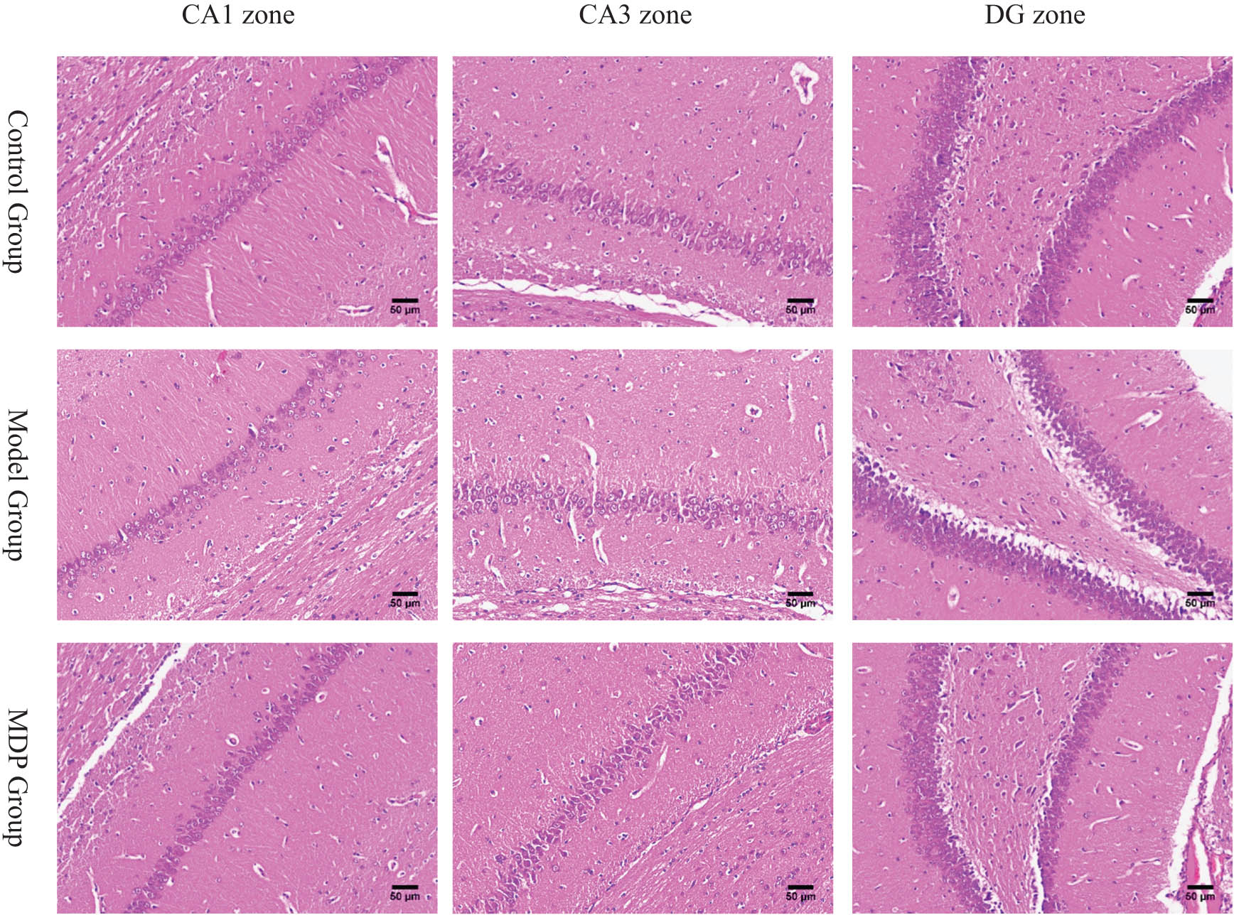 Figure 1 
                  The pathology of CA1, CA3, and DG zones in the hippocampus among the three groups. CCH induced neurons loss, white matters loosen and disarrange in CA1, CA3, and DG zones in the hippocampus. MDP significantly restored them. Using Image J software, we calculated that the total neurons in the CA1 zone are, respectively, 155 ± 21, 110 ± 18, 182 ± 36 per slice (400 times magnetite). There are significant differences between the two groups (P < 0.05).
               