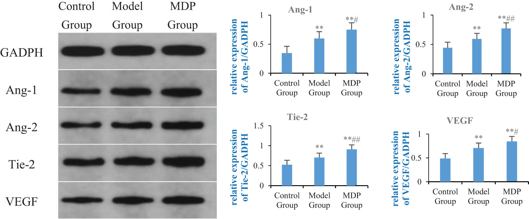 Figure 3 
                  Expressions of Ang-1, Ang-2, Tie-2, and VEGF in the hippocampus among the three groups. Using GAPDH as the inner reference, the relative expression levels of Ang-1, Ang-2, Tie-2, and VEGF in the hippocampus form are calculated. The left image shows the immunoblotting of GAPDH, Ang-1, Ang-2, Tie-2, and VEGF, while the right bar graph, respectively, shows the relative expression levels of Ang-1, Ang-2, Tie-2, and VEGF in each group of rats. **P < 0.01 vs control group; #
                     P < 0.05 vs model group; ##
                     P < 0.01 vs model group.
               