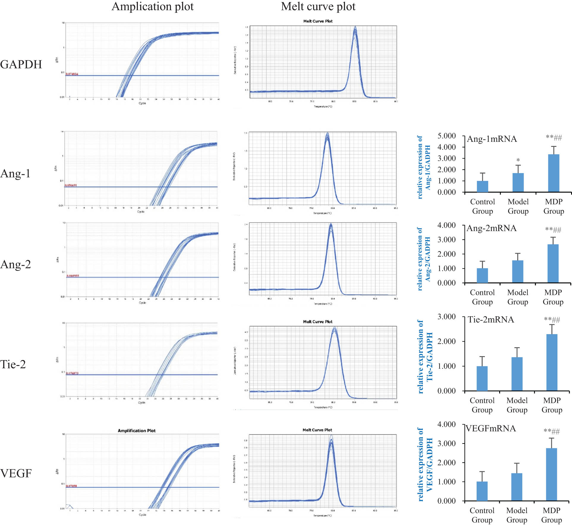 Figure 4 
                  Expressions of Ang-1 mRNA, Ang-2 mRNA, Tie-2 mRNA, and VEGF mRNA in the hippocampus among the three groups. Using GAPDH as the inner reference, the relative expression levels of Ang-1 mRNA, Ang-2 mRNA, Tie-2 mRNA, and VEGF mRNA in the hippocampus form are calculated. The left image shows the amplification and fusion curves of GAPDH, Ang-1, Ang-2, Tie-2, and VEGF genes. The right bar graph shows the relative expression levels of Ang-1 mRNA, Ang-2 mRNA, Tie-2 mRNA, and VEGF mRNA in each group of rats. **P < 0.01 vs control group; *P < 0.05 vs control group; ##
                     P < 0.01 vs model group.
               
