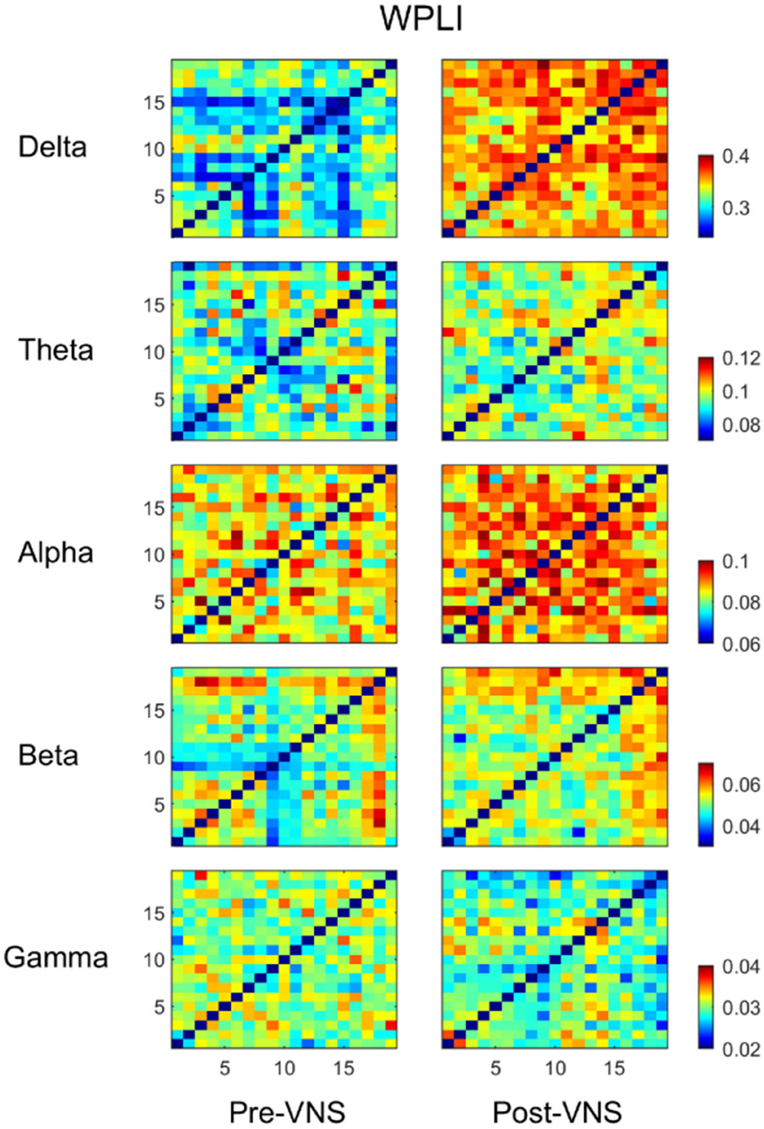 Figure 3 
                  VNS-induced changes of the brain correlation matrices in five different frequency bands EEG.
               