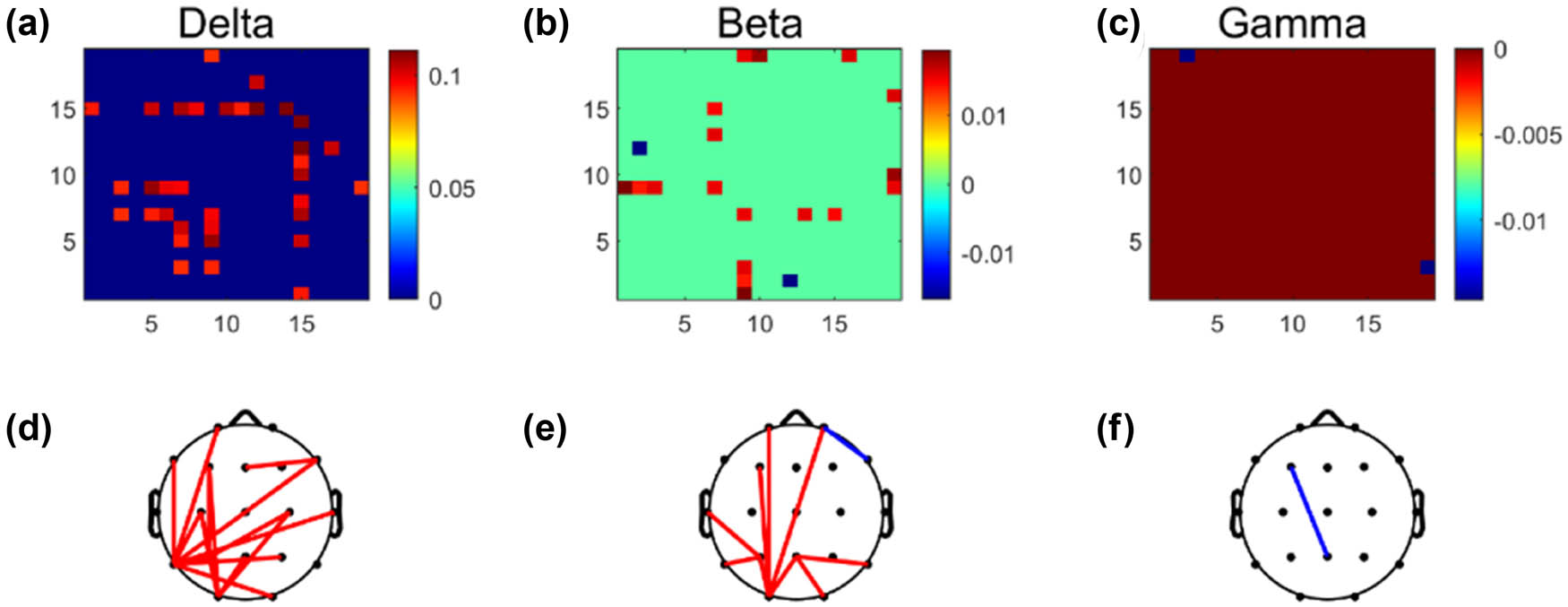Figure 4 
                  Brain functional connection matrices with significant differences in three different frequency bands of EEG: (a) delta band, (b) beta band, and (c) gamma band; (d)–(f) the brain network topology with significant differences in three frequency bands.
               