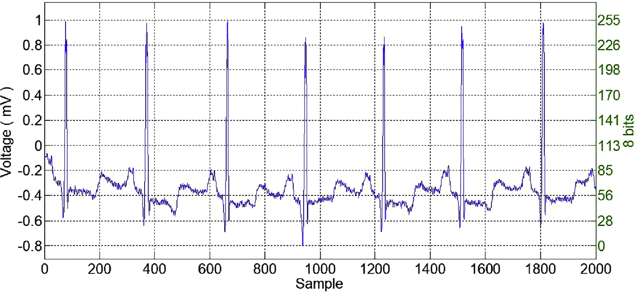 Figure 5: An example ECG signal received from Physiobank and the converted to eight bits before encryption.