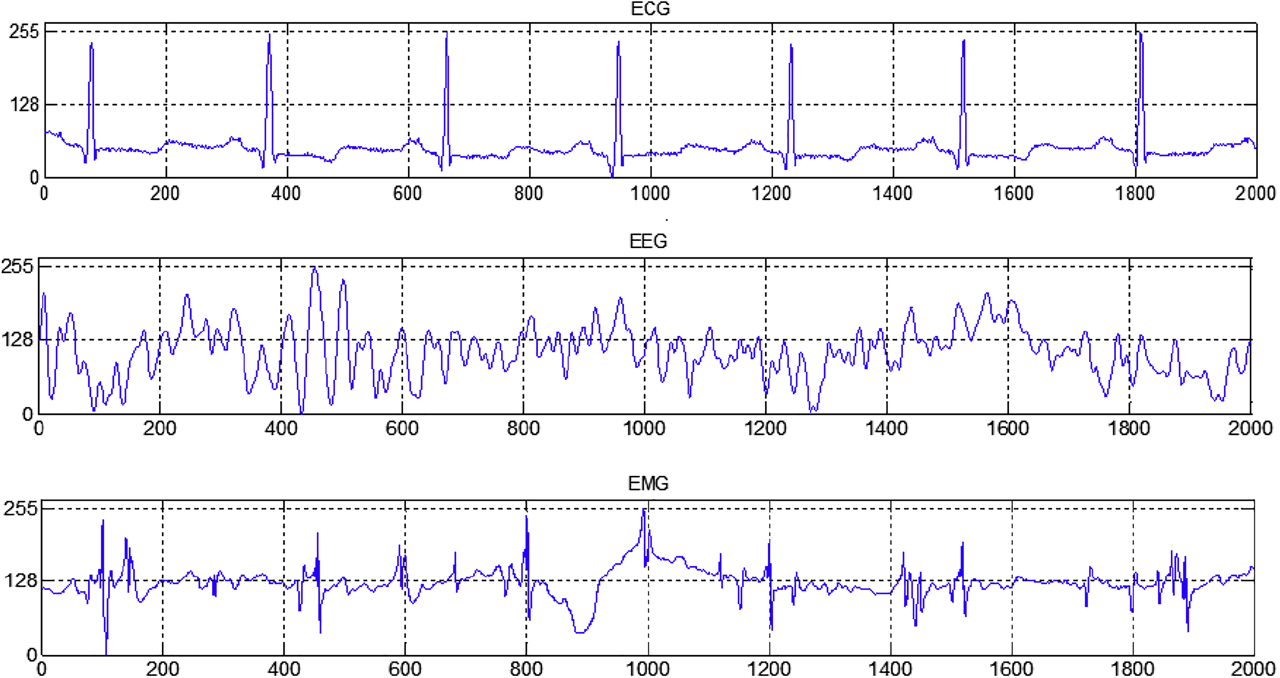 Figure 7: Data hidden electrophysiological signals.