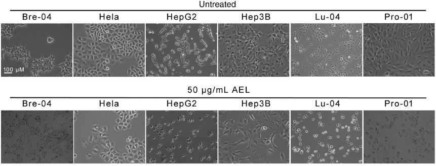 Figure 1: Effects of AEL on the morphology of human tumor cell lines.The indicated human tumor cells were treated with or without 50 μg/mL AEL for 24 h, and their morphologies were examined under a phase contrast microscopy. We used size bar in one of the panels.