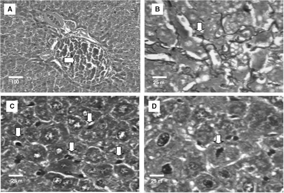 Figure 4: Histopathology of liver of experimental groups: (A) lobular and portal venous congestion – 5-FU (50 mg/kg); (B) reticulin collapse – OEL (50 mg/kg); (C) Kupffer cell hyperplasia – OEL (100 mg/kg) and (D) isolated mitoses – OEL (100 mg/kg). Hematoxylin-eosin (A, C and D) and Gordon and Sweet method for reticulin (B).