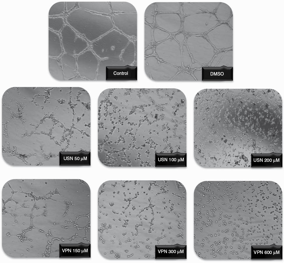 Figure 4: Effects of (-)-usnic acid (USN) and vulpinic acid (VPN) on human umbilical vein endothelial cell (HUVEC) tube formation.
