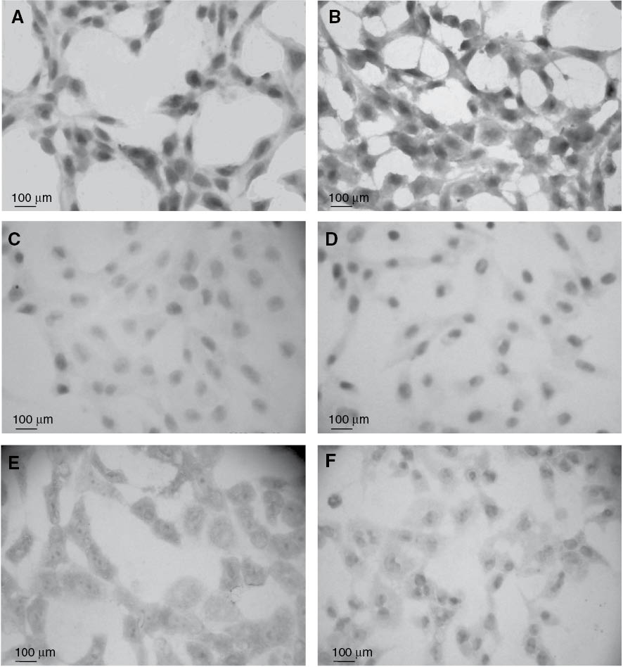 Figure 3: Abundance of Fas, p53 and Bcl-2 in control and curcumin-treated HSCs. Fas (A, B): HSCs of the negative-control group (A), which was treated identically to the other groups, but in the absence of curcumin. HSCs treated with 20 μM curcumin (B). Dark grains, revealing the presence of Fas in both membrane and cytosol after immunocytochemical staining, are significantly more numerous in B as compared to A. p53 (C, D): HSCs of the negative-control group (C), and of the curcumin-treated group (D). Dark grains, revealing the presence of p53 in the nuclei after immunocytochemical staining, are significantly more numerous in D as compared to C. Bcl-2 (E, F): HSCs of the negative-control group (E) and of the curcumin-treated group (F). Dark grains, revealing expression of Bcl-2 at the cell membrane after immunocytochemical staining, are significantly more numerous in E as compared to F.