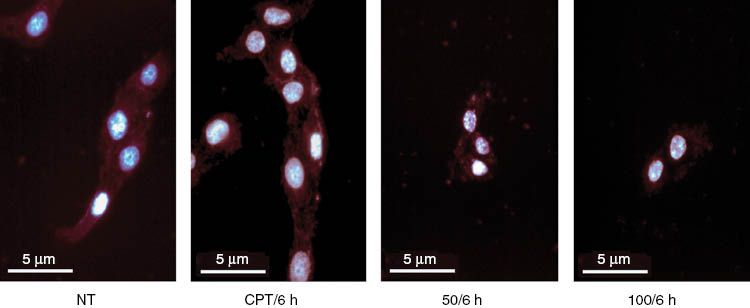 Figure 4: Morphological aspects of U2OS cells. After treatment with 50 or 100 μg mL–1 of H. longiflorus extract for 6 h, the cells were stained with DAPI and sulforhodamine101 (SR). Camptothecin CPT (12 μM) was used as positive control. The treatment revealed shrinkage of the cells or decrease in cell size. NT, Non treated cells.