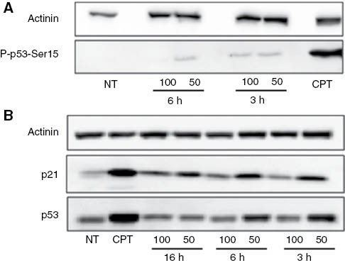 Figure 6: Induction of the p53-p21 pathway. U2OS cells were incubated with 50 and 100 μg mL–1H. longiflorus extract for 3, 6, and 16 h. Cell lysates were prepared and subjected to SDS-PAGE. Actinin was used as a loading control.(A) P-p53-Ser15 (lower panel). (B) p21 (central panel) and p53 (lower panel). Camptothecin (CPT) (12 μM) was used as positive control. Results are from one experiment representative of three similar experiments. NT, Non treated cells.