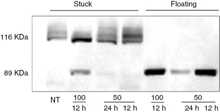 Figure 7: Western blot analysis of PARP-1 protein from the stuck (live cells) and floating (dead cells) samples, as indicated. Both the 116 kDa full-length protein, and the 89 kDa proteolytic fragment were detected using the monoclonal antibody C-2-10. NT, Non treated cells.