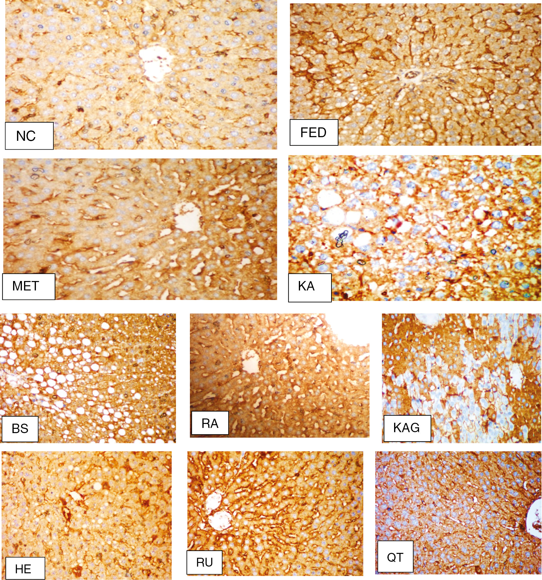 Figure 2: Immunohistochemical (iNOS) findings (original magnification×200). NC group, no detectable stain in the cytoplasm or nuclei; FED group, with uniform distribution of stain in the hepatocytes; MET group, no detectable stain in the cytoplasm or nuclei; KA group, with staining of cytoplasm without nuclei; BS group, with moderate detectable stain; RA group, with strong staining of hepatocytes cytoplasm and nuclei; KAG group, with patchy areas with detectable staining of both cytoplasm and nuclei; HE group, with relative staining of iNOS in the cytoplasm of the hepatocytes; RU group, hepatocytes showing moderate staining of both cytoplasm and nuclei; QT group, hepatocytes showing staining of cytoplasm without nuclei.