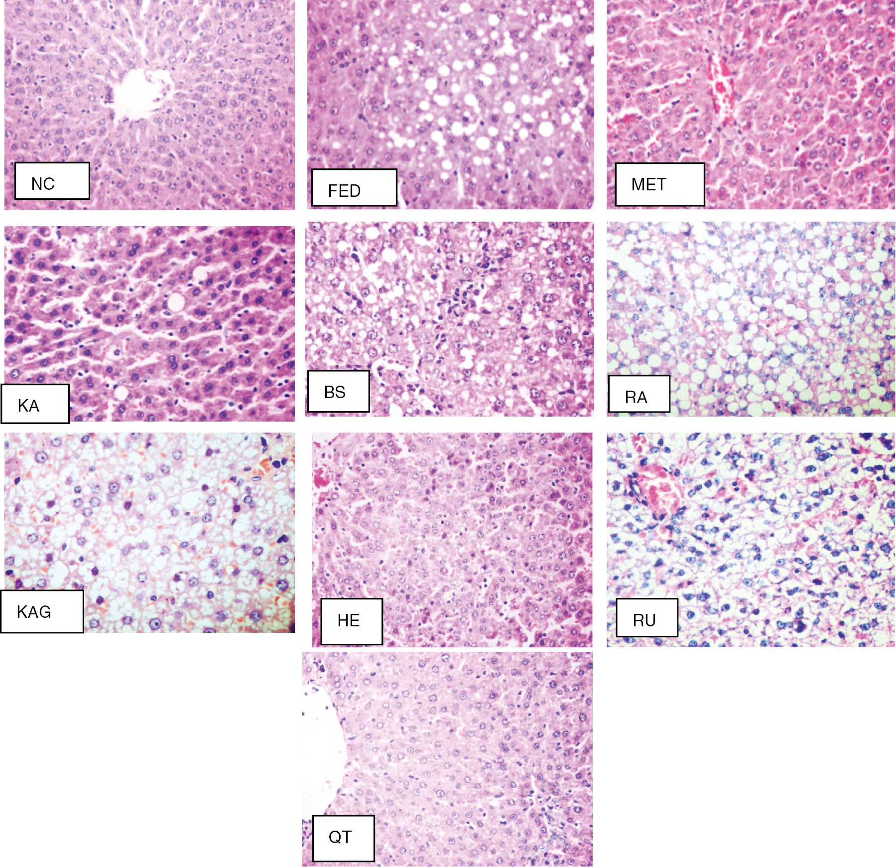 Figure 3: Histopathological examination (original magnification×200). NC group, normal histological structure (score 0); FED group, severe steatosis (score 3); MET group, complete absence of steatosis (score 0); KA group, with few fatty cells (score 1); BS group, steatosis (score 2), lobular inflammation (score 2) and ballooning (score 1); RA group, steatosis (score 3), lobular inflammation (score 2) and ballooning (score 2); KAG group, with ballooning and steatosis (score 2) with lobular inflammation (score 1); HE group, with cell ballooning (score 1), lobular inflammation (score 2), and apoptosis. RU group, cell ballooning (score 2) and lobular inflammation (score 1).