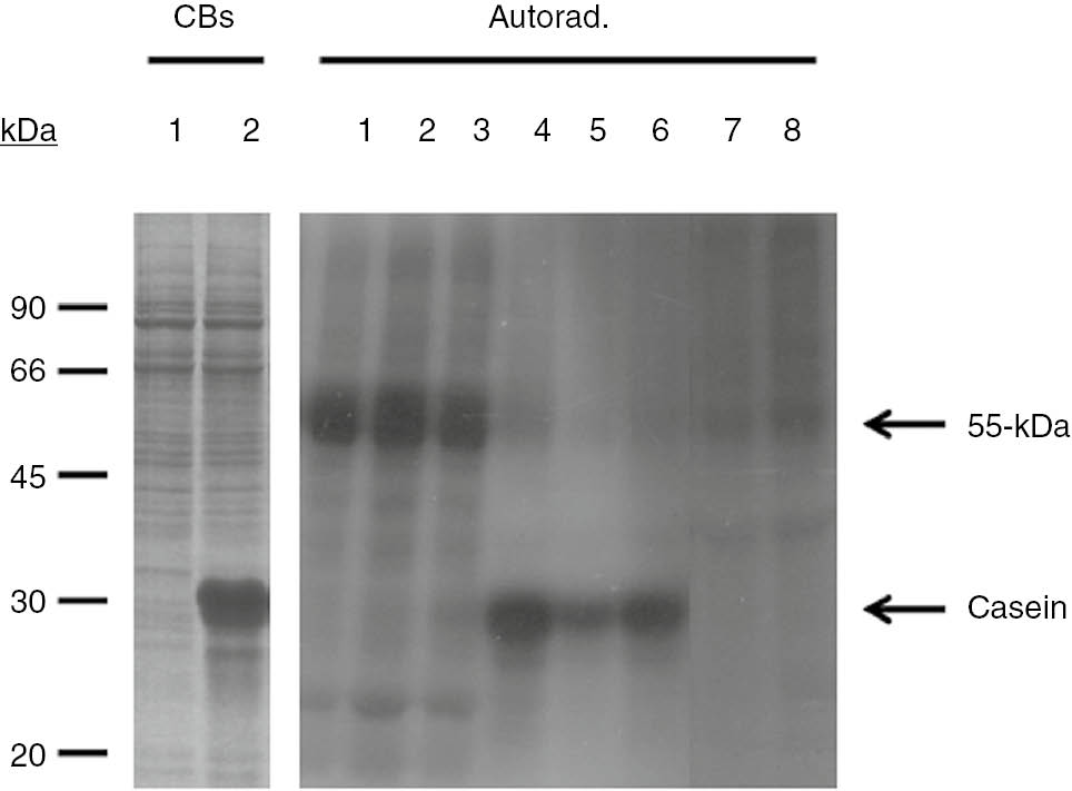 Figure 1: SDS-PAGE separation of whole-cell lysates from T. equiperdum. CBs, polypeptide profile revealed by Coomassie Blue staining. Shown are parasite homogenates in the absence (1) or presence of dephosphorylated casein (2). In vitro kinase activity was assayed in the presence of [γ-32P] ATP and the labeled gel was dried and analyzed by autoradiography (Autorad.). Shown are the endogenously phosphorylated bands in the absence (1), or in the presence of either 100 μM emodin (7) or 150 μM GTP (8). Control experiments containing just the vehicles used to dissolve emodin (0.01 M NaOH and 0.1% dimethyl sulfoxide) and GTP [50 mM Tris-HCl (pH 8.0)] were included in lanes 2 and 3, respectively. Casein kinase activity was determined by including 1 mg/mL of dephosphorylated casein to the reaction mixtures, in the absence (4) or presence of either 100 μM emodin (5) or 150 μM GTP (6).