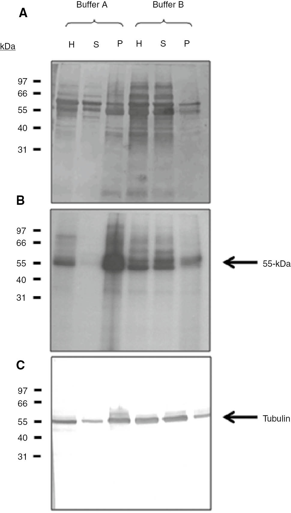 Figure 2: Effect of divalent cations and chelating agents on the solubility of tubulin and tubulin kinase from T. equiperdum. Whole-cell homogenates (H), soluble (S) and particulate (P) fractions were obtained from T. equiperdum parasites extracted with either 50 mM Tris-HCl (pH 8.0), 5 mM MgCl2 and 5 mM CaCl2 (buffer A) or 50 mM Tris-HCl (pH 8.0), 10 mM EGTA and 10 mM EDTA (buffer B) and separated by SDS-PAGE. Panel A shows the resulting polypeptide profile. Phosphorylation assays were performed with [γ-32P] ATP and the [32P]-labeled phosphopolypeptides were separated by SDS-PAGE on a 12% gel and electrotransferred to a PVDF membrane. The membrane was exposed to X-ray film at −80°C, using an intensifying screen and visualized by autoradiography (panel B). Western blot employing a mixture of anti-α and β tubulin monoclonal antibodies (panel C).