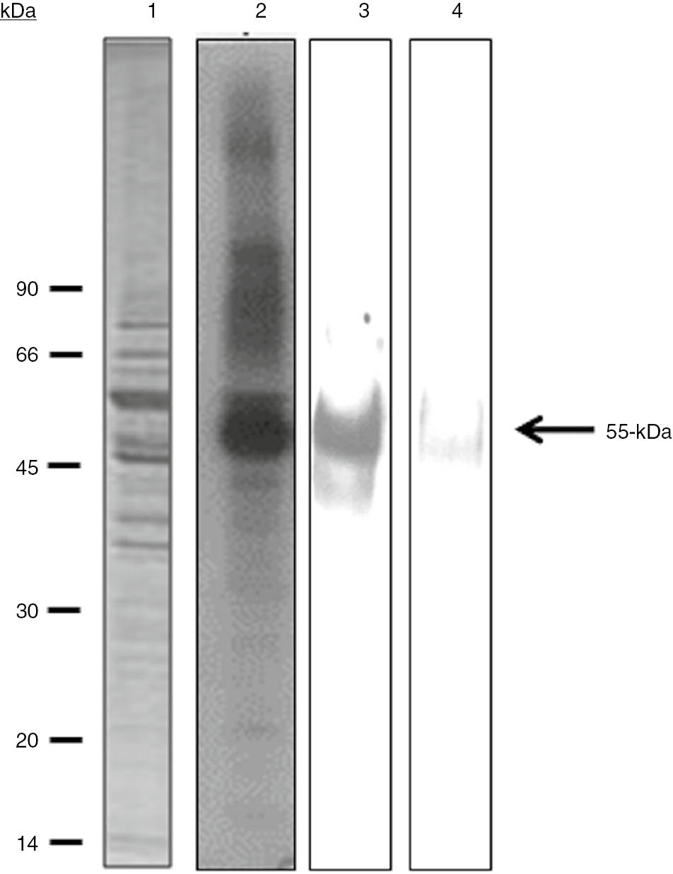 Figure 3: Immunoprecipitation with anti-tubulin monoclonal antibodies. The clarified soluble fraction was obtained from T. equiperdum parasites extracted in the presence of 10 mM EDTA and 10 mM EGTA. A sample of the parasite soluble fraction was phosphorylated in vitro and directly analyzed by SDS-PAGE followed by autoradiography (2) or immunoprecipitated by either a mixture of anti-α and β tubulin monoclonal antibodies (3) or a polyclonal antibody directed against the soluble form of a VSG from the same strain of T. equiperdum (4). The polypeptide profile revealed by Coomassie blue staining is shown in lane 1.