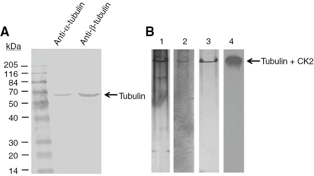 Figure 6: Association of a pool of tubulin and the CK2 responsible for its phosphorylation. (A) Fractions containing the protein peak from the Sephacryl S-300 column were combined and analyzed by western blot using either anti-α tubulin or anti-β tubulin monoclonal antibodies. (B) Native electrophoresis of the purified CK2-tubulin complex previously phosphorylated with [γ-32P] ATP. Protein staining using silver (1), immunoblot using either an anti-CK2 α-subunit polyclonal antibody (2) or a mixture of anti-α and anti-β tubulin monoclonal antibodies (3), analysis of [32P] labeling by autoradiography (4).