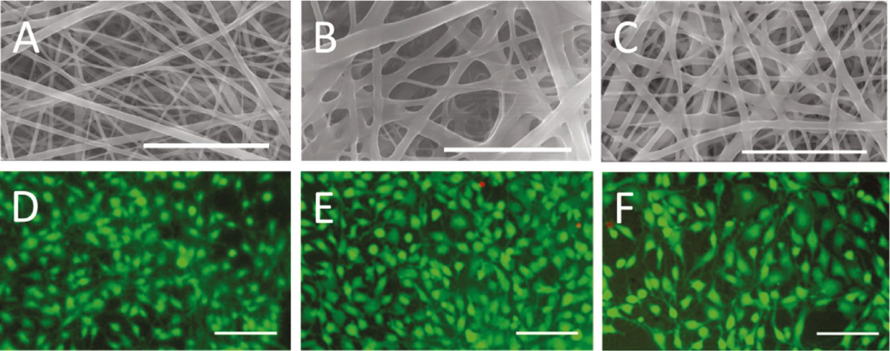 Figure 4: Electrospun SELP-47K mats were tested as scaffolds for fibroblast.(A)–(C) SEM images of (A) methanol, (B) glutaraldehyde, and (C) methanol and glutaraldehyde treated non-woven mats electrospun from a 15% (w/v) protein solution. Scale bars: 5 μm. (D)–(F) Fluorescent staining for cell viability of fibroblasts grown for 5 days on (D) methanol, (E) glutaraldehyde, and (F) methanol and glutaraldehyde treated SELP-47K scaffolds. Living cells exhibited green, dead cells, red fluorescence. Scale bars: 50 μm. Reprinted and adapted with permission from [77], copyright 2010 American Chemical Society.