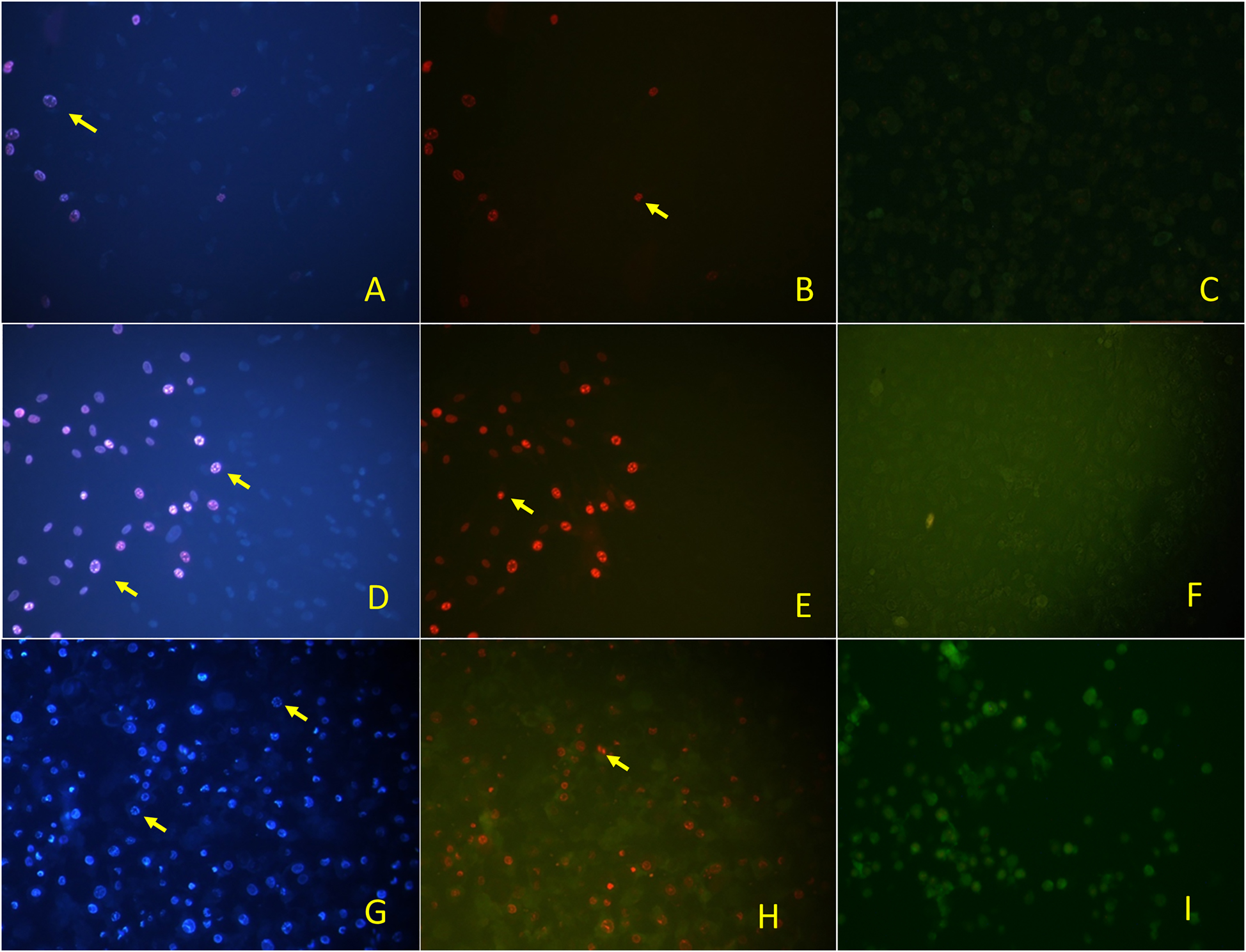 Figure 6: 
Fluorescence inverted microscopy image of c-AgNPs on L929 cells, DAPI filter (A), FITC filter (B), and control (C), on A549 cells, DAPI (D), FITC (E), and control (F) on DLD-1 cells, DAPI (G), FITC (H), and control (I). DAPI images indicated the apoptotic cells and FITC images indicated the necrotic cells.