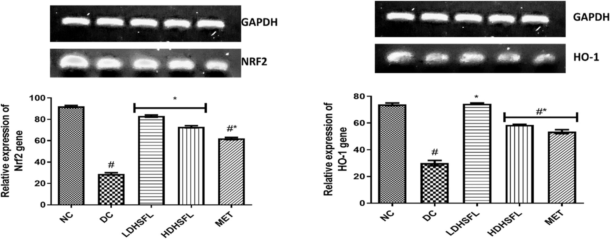 Figure 6:
Relative gene expression of Nrf2 and HO-1 in STZ-induced diabetic rats after administration of flavonoid-rich H. sabdariffa leaf extract. Each value represents the mean of eight measurements ± SD #p < 0.05 versus NC, *p < 0.05 versus DC. NC, normal control; DC, diabetic control; LDHSFL, diabetic rats given a low dose (150 mg/kg body weight) of flavonoid-rich extract of H. sabdariffa; HDHSFL, diabetic rats given a high dose (300 mg/kg body weight) of flavonoid-rich extract of H. sabdariffa; MET, diabetic rats given 200 mg/kg of metformin.